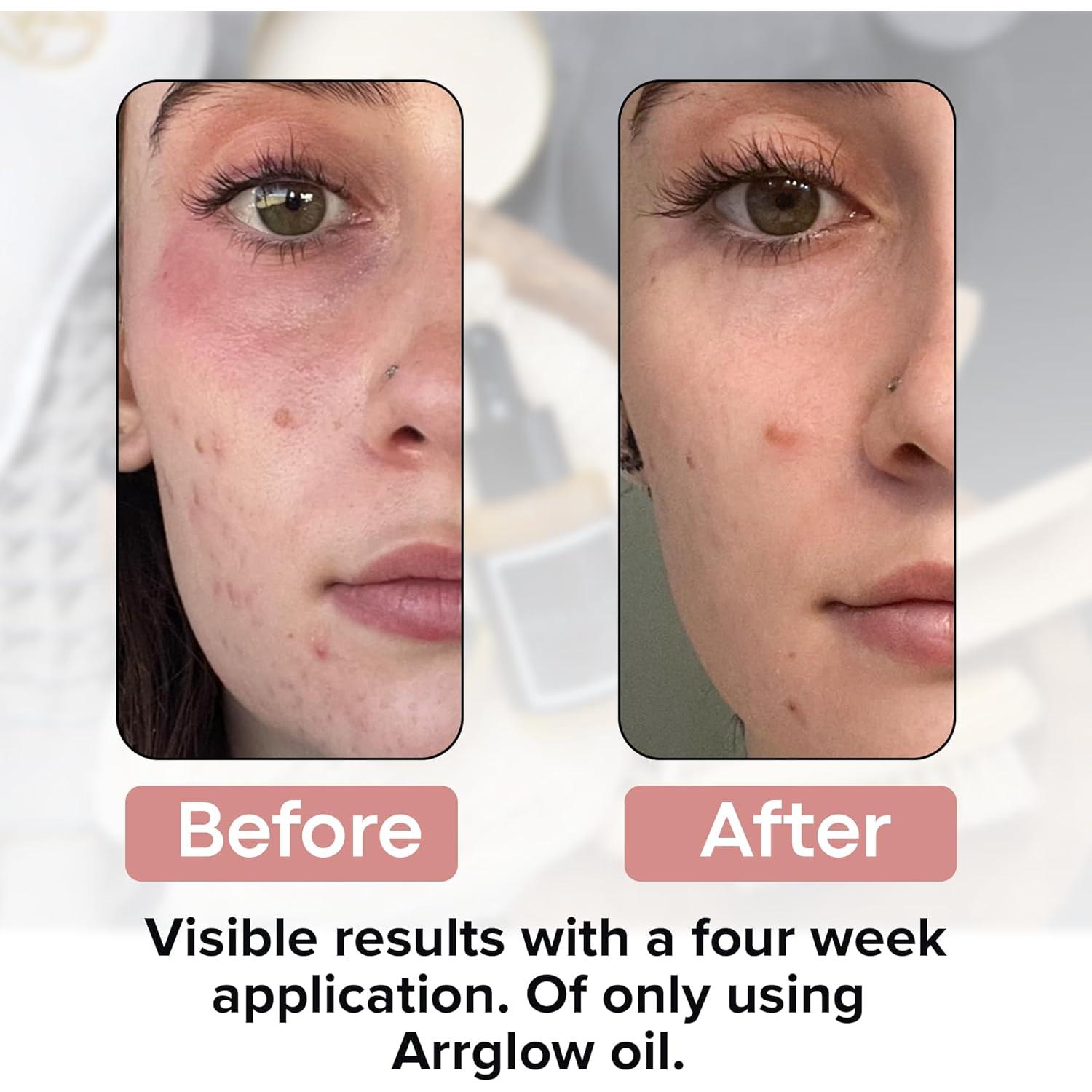 Aceite Facial Anti Envejecimiento Arrglow 30ml - Jojoba, Incienso, Argán