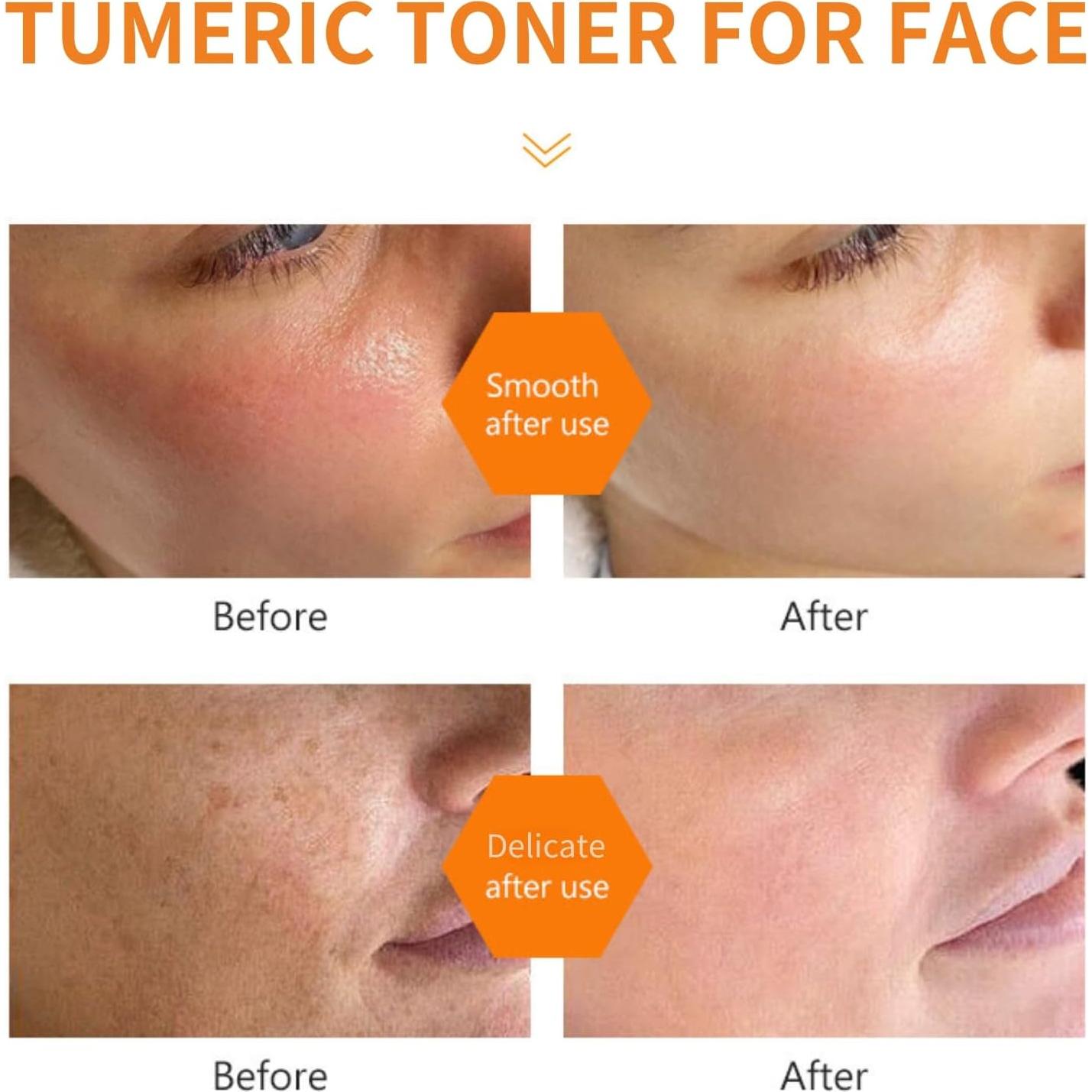 Tónico Facial de Cúrcuma Evolvique 159g - Hidratante y Anti-Envejecimiento