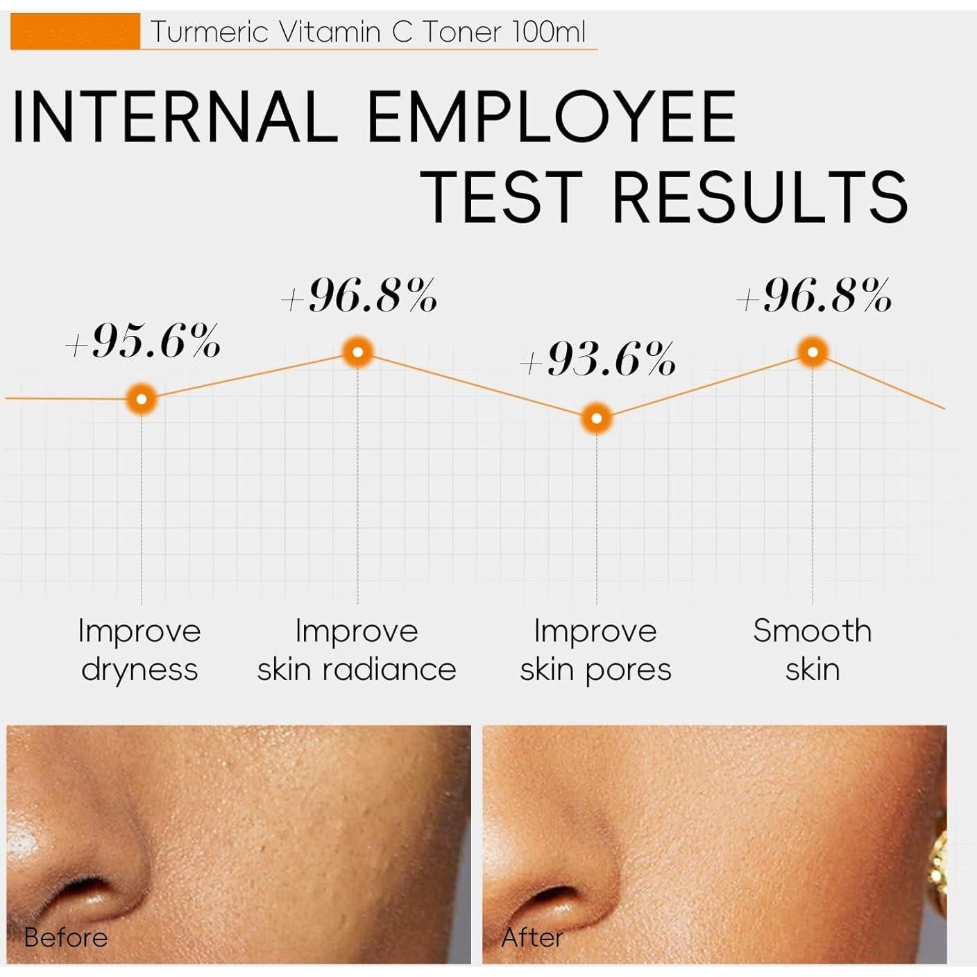 Tónico Hidratante de Cúrcuma con Vitamina C 100ml - BSMKCL