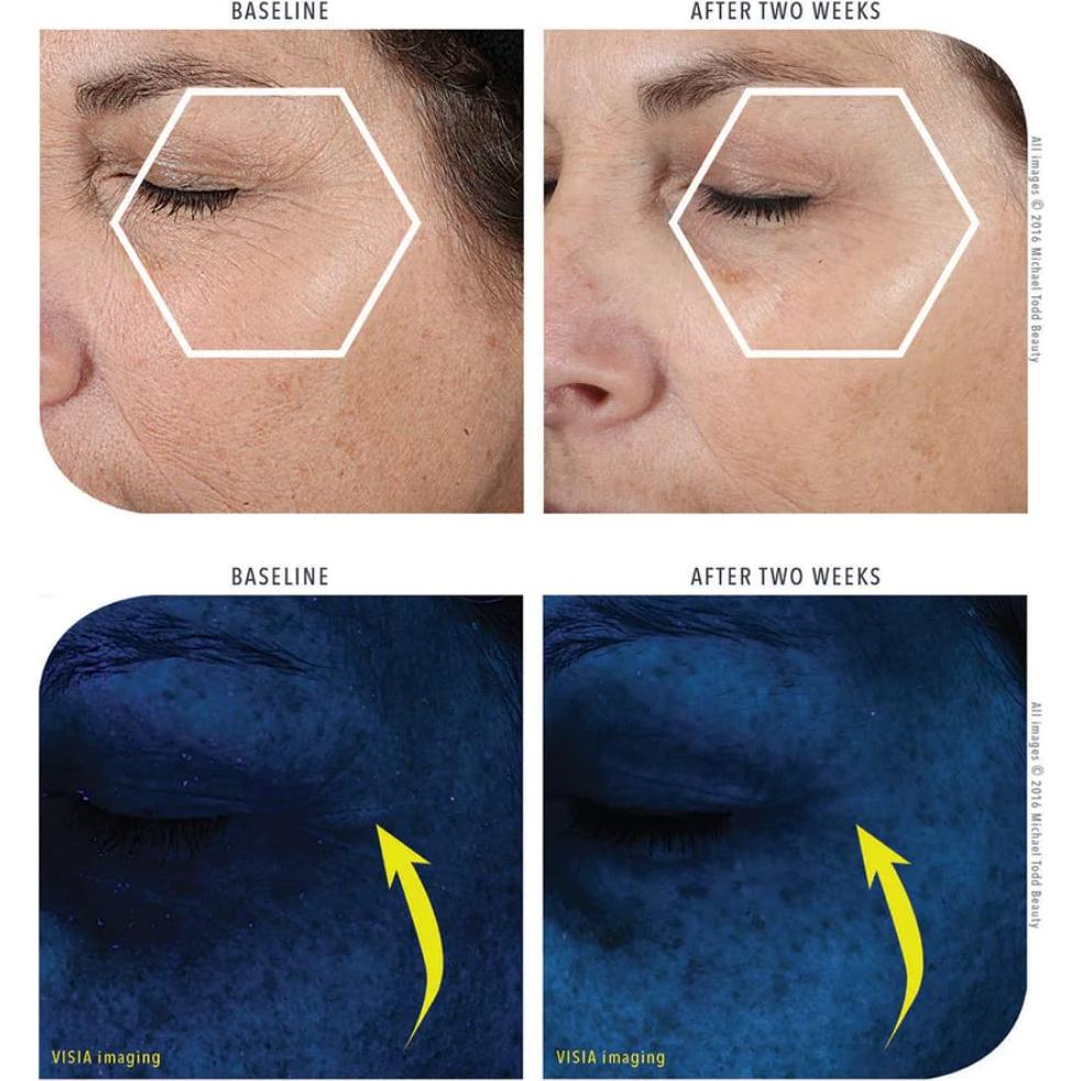 Crema KNU Michael Todd Beauty 50 mL - Hidratante y Rejuvenecedora