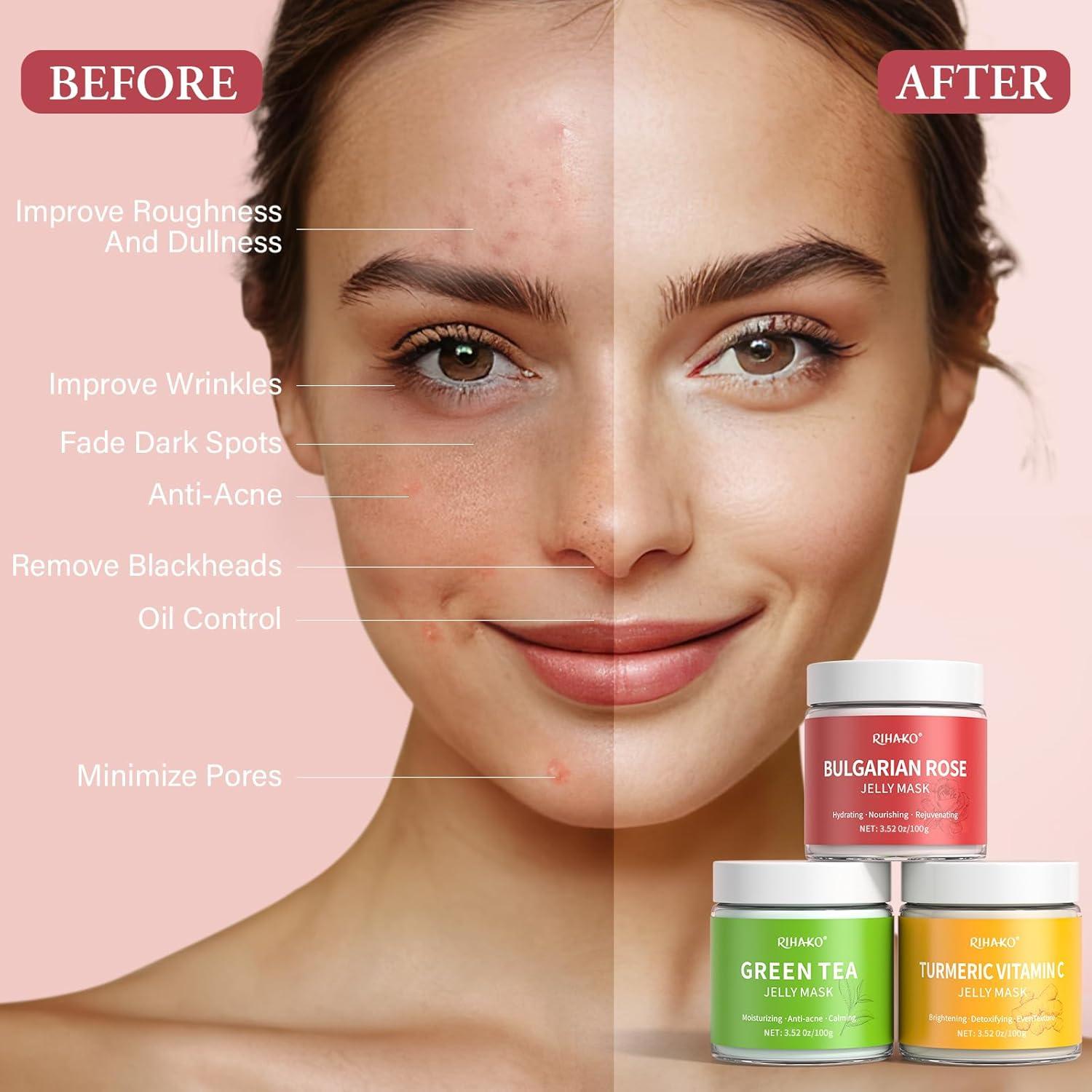 Set de Mascarillas de Gel RIHAKO - Cúrcuma, Rosa y Té Verde