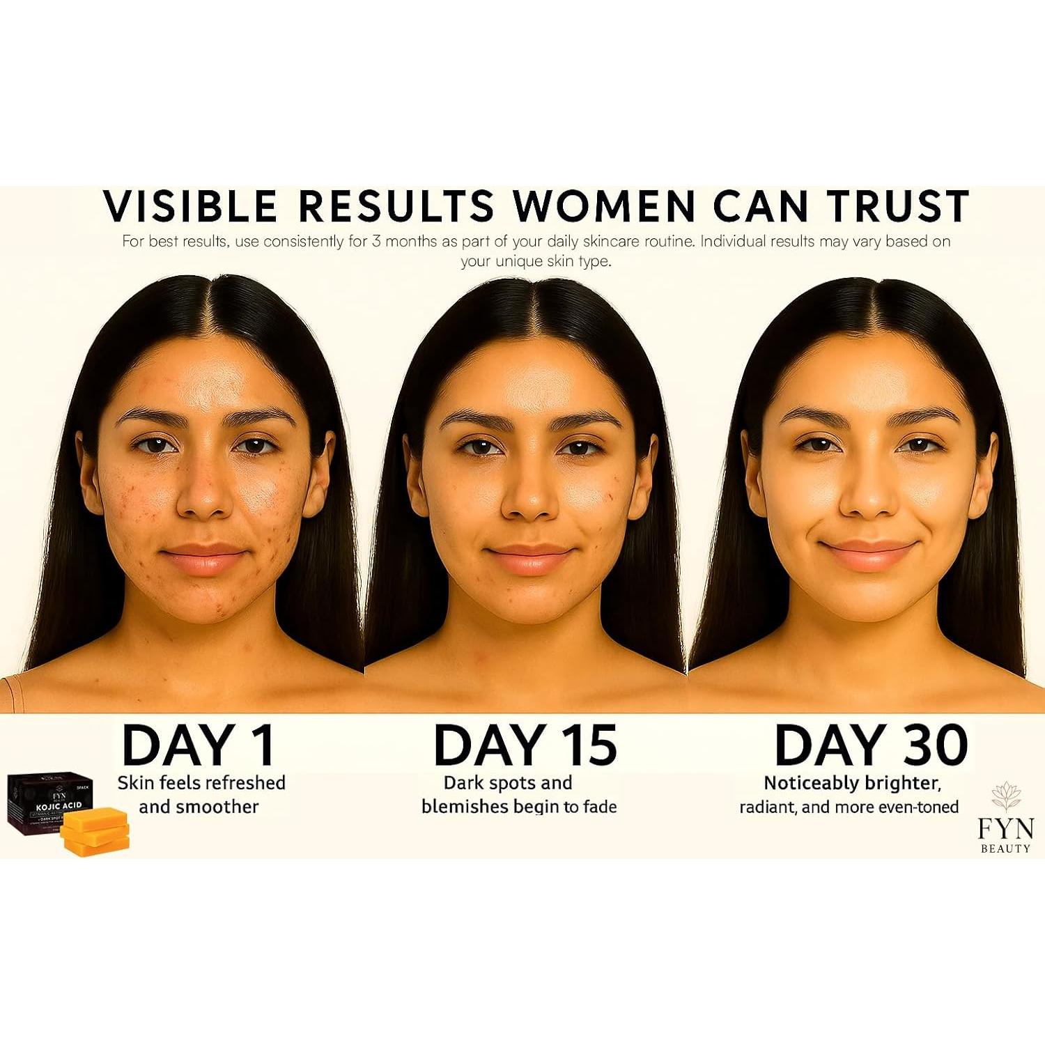 Jabón de Ácido Kójico FYN Beauty - 3 Piezas para Manchas y Rejuvenecimiento