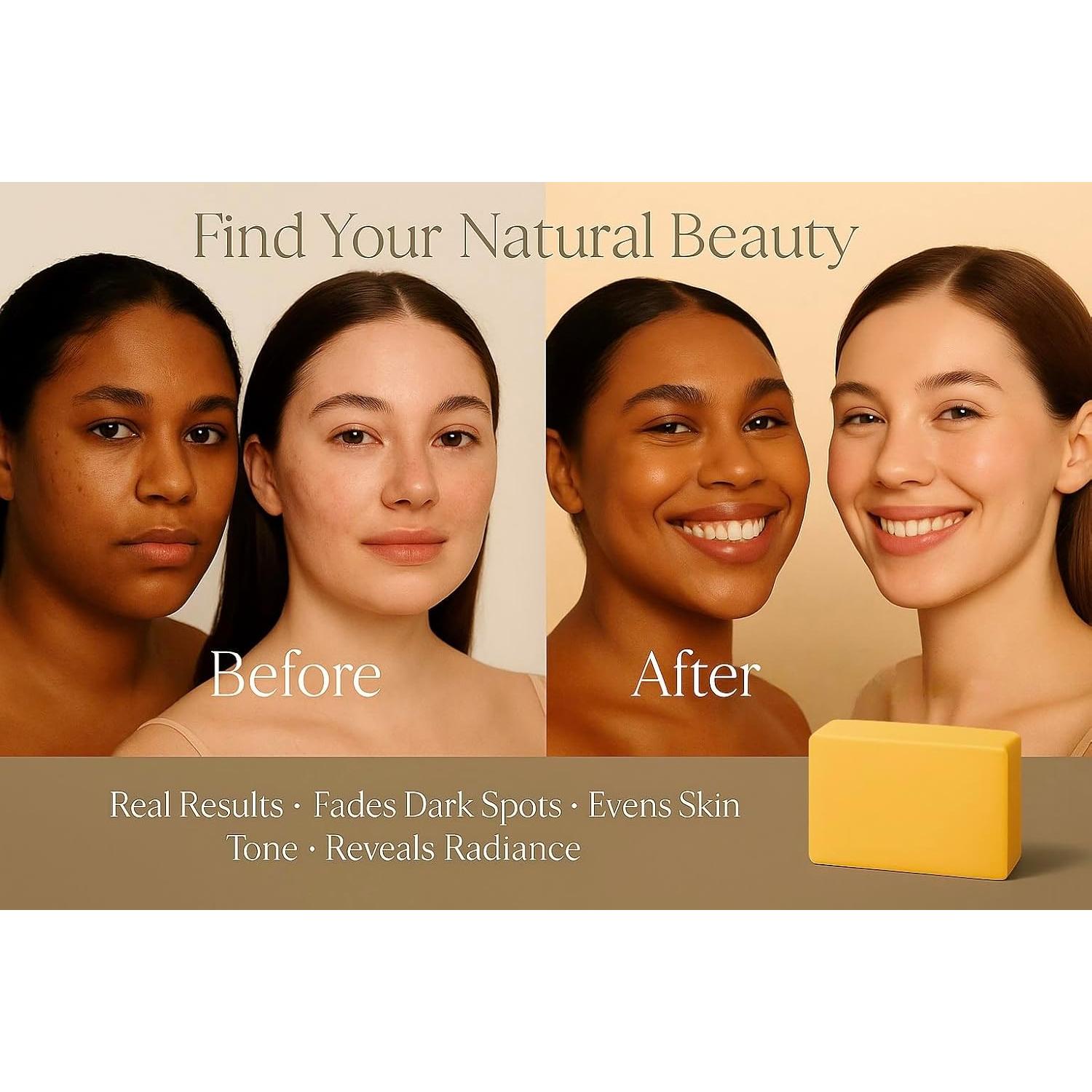 Jabón de Ácido Kójico FYN Beauty - 3 Piezas para Manchas y Rejuvenecimiento