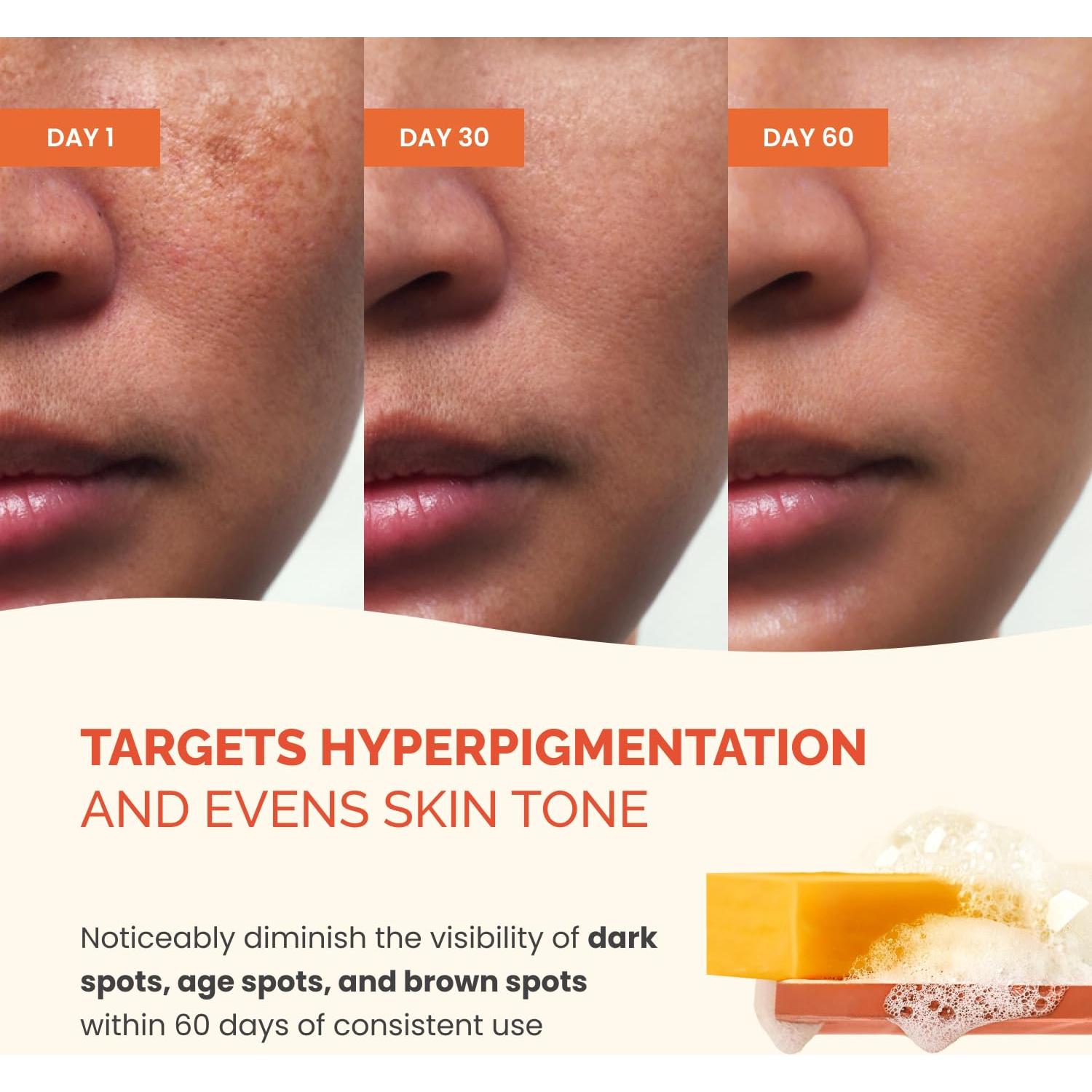 Jabón de Ácido Kojico Plantifique 160g - 2 Barras para Piel Uniforme