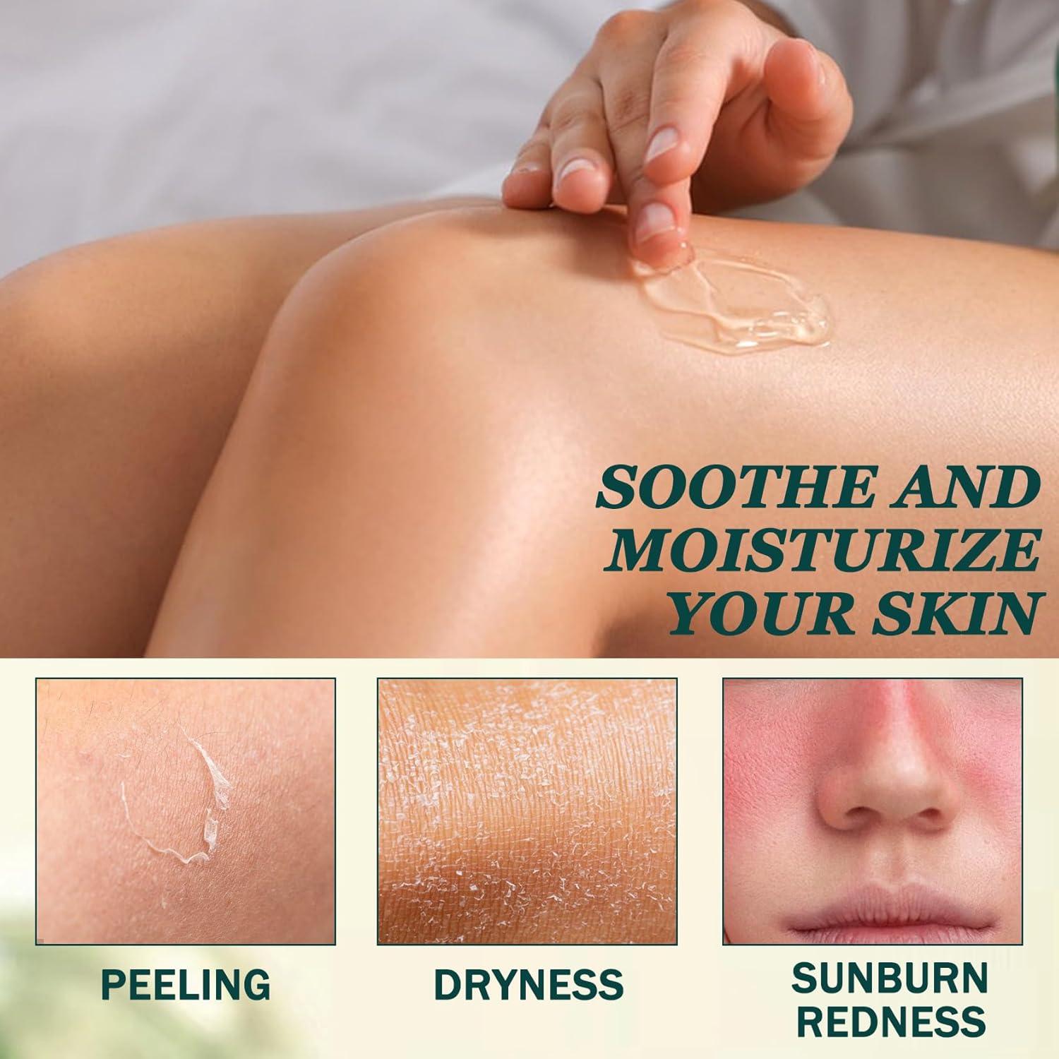 Gel de Aloe Vera Orgánico QSLYUYUAN 308g Hidratante Piel