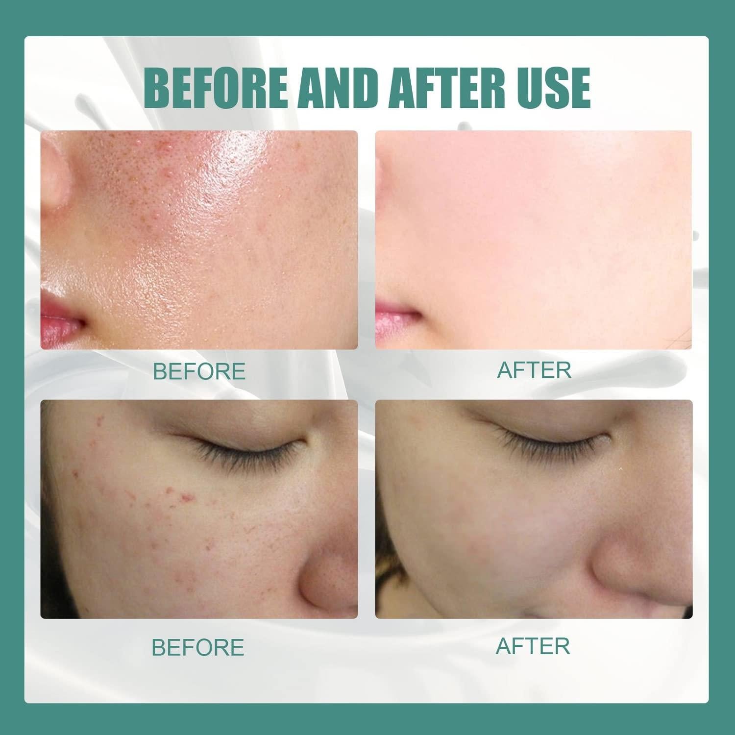 Jabón Blanqueador de Colágeno SkinFerm 60g - 2 Piezas