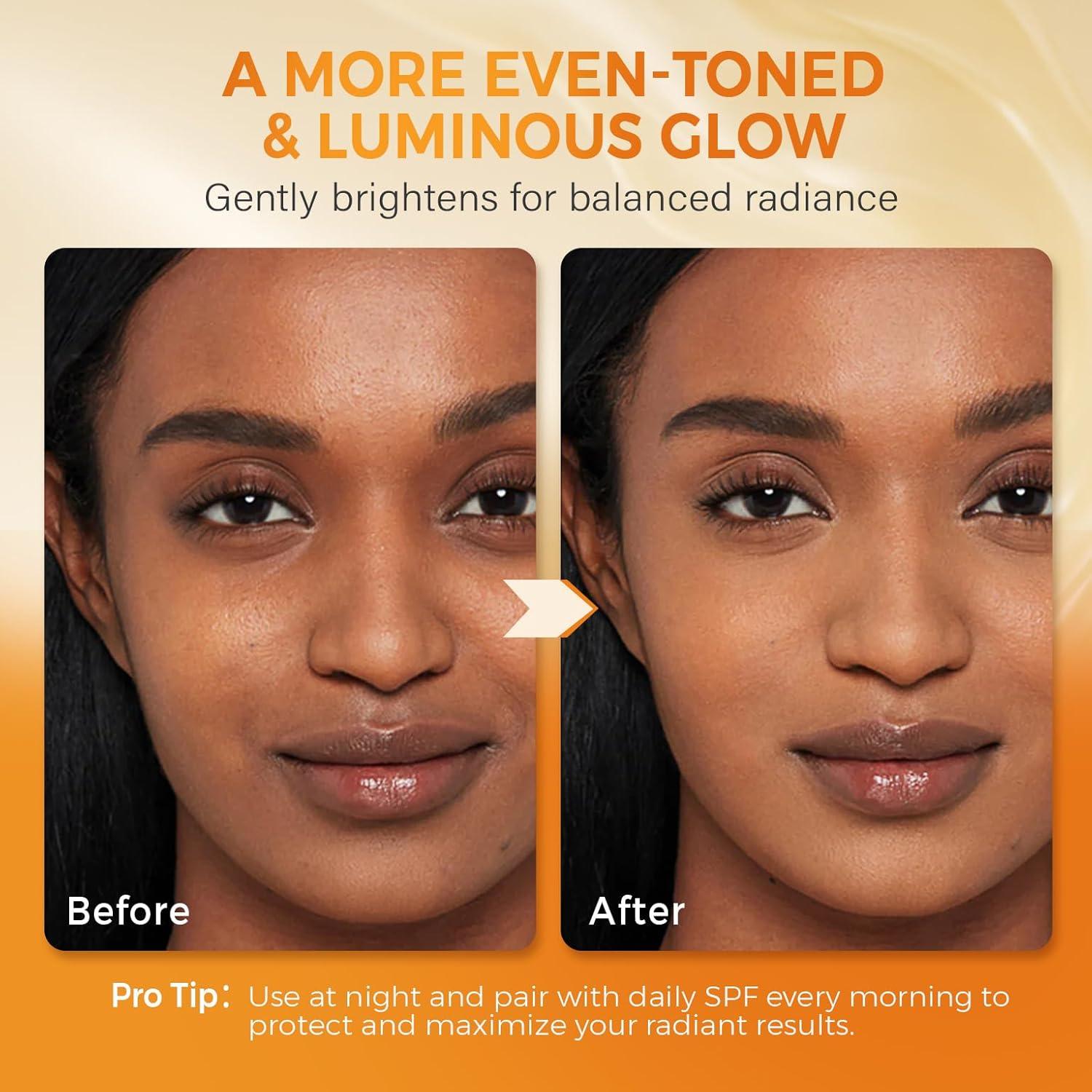 Jabón Aclarador QOOQ con Ácido Kójico y Cúrcuma 480g