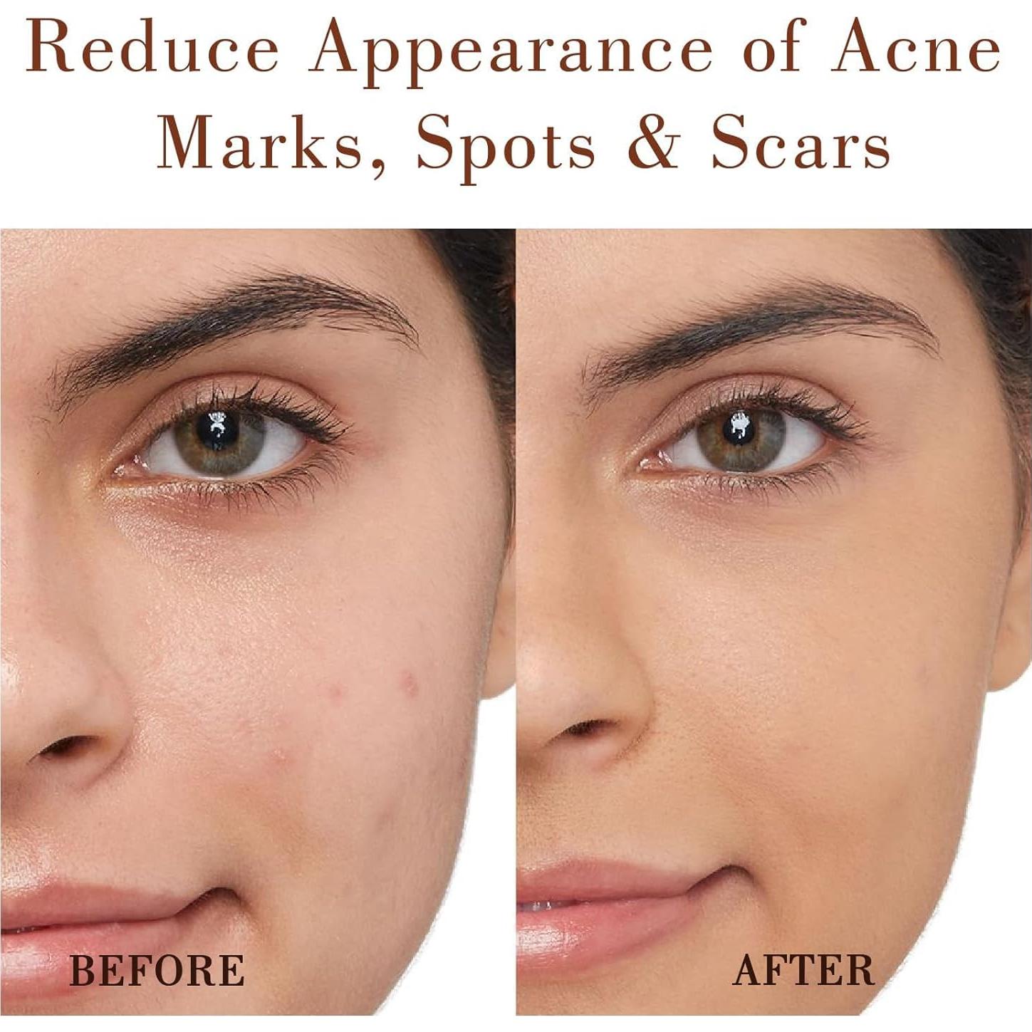 Aceite de Rosa Mosqueta Orgánico MMPANG 125 ml Puro Antienvejecimiento