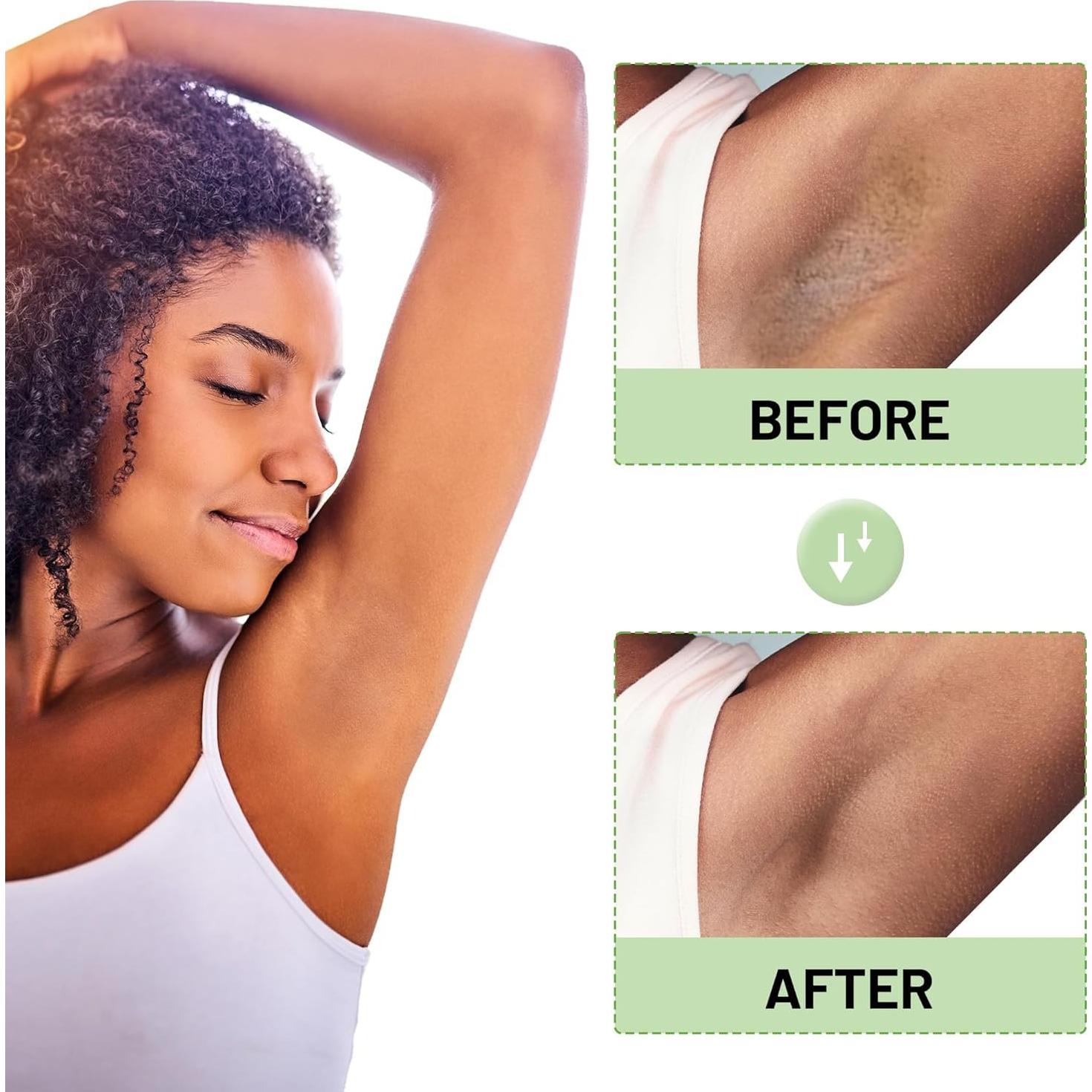 Crema Aclaradora para Áreas Íntimas Ceavo 30 ml