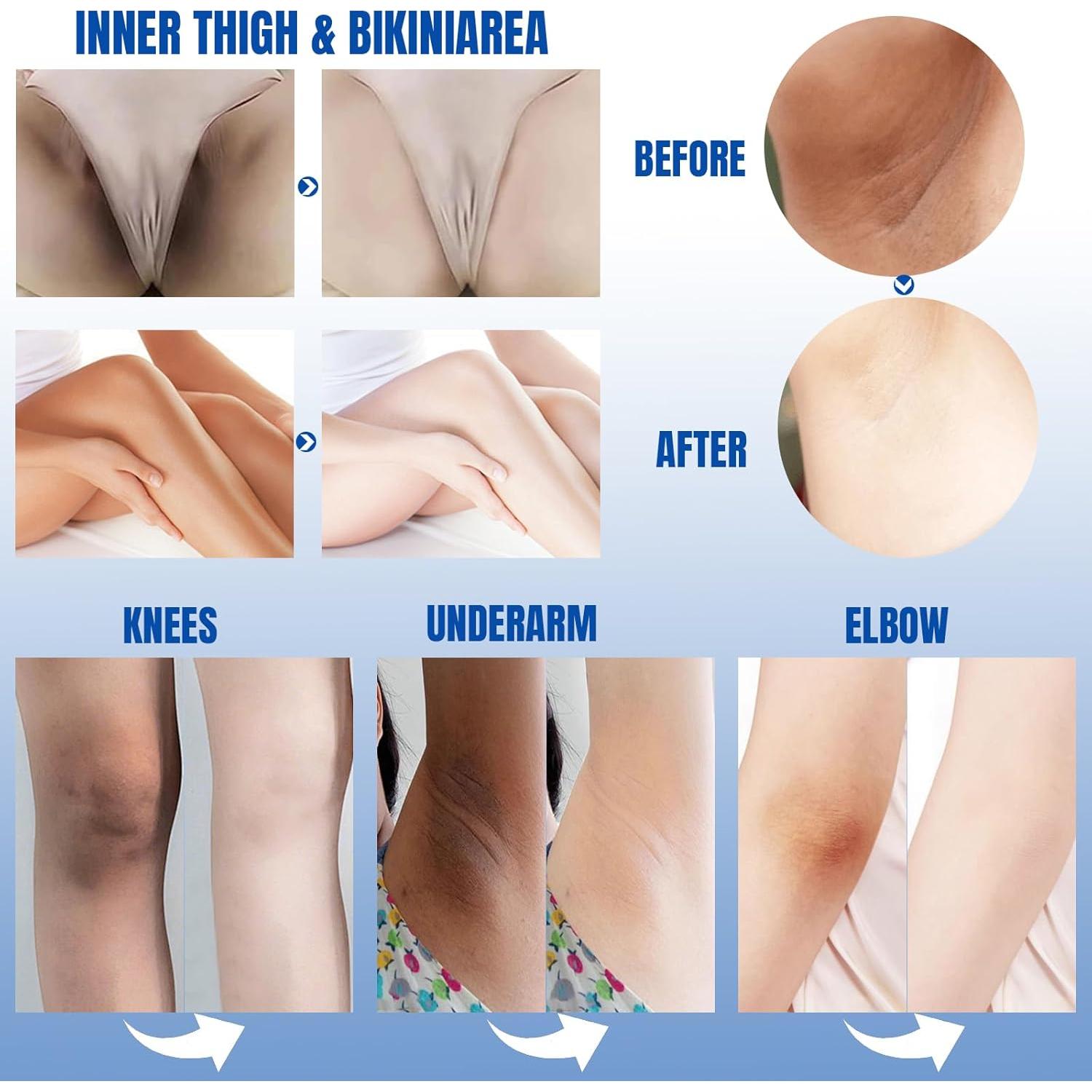 Crema Aclaradora de Piel Jeosisy 99.9g Hidratante para Áreas Íntimas