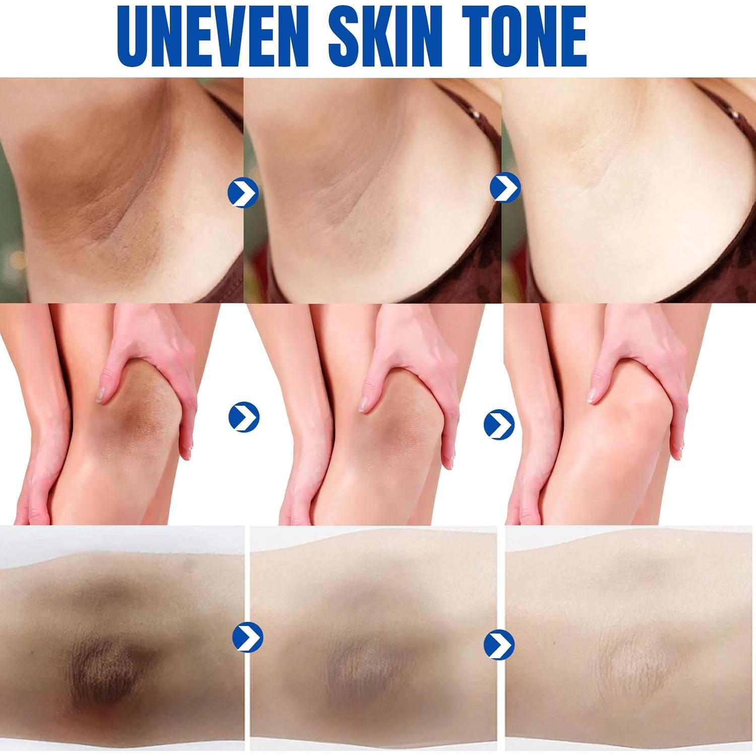 Crema Aclaradora de Piel Jeosisy 99.9g Hidratante para Áreas Íntimas