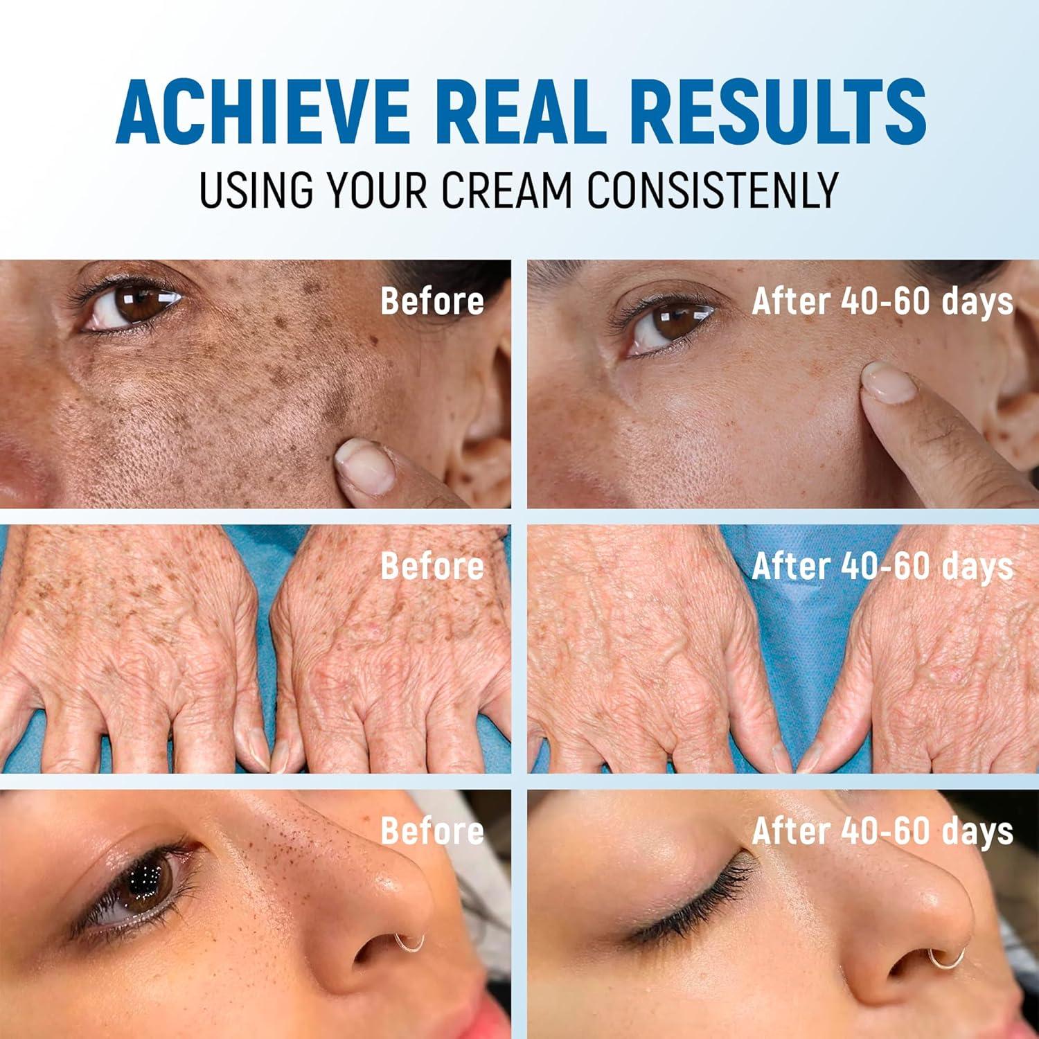 Crema Aclaradora de Manchas Oscuras PENEBELLA 108g