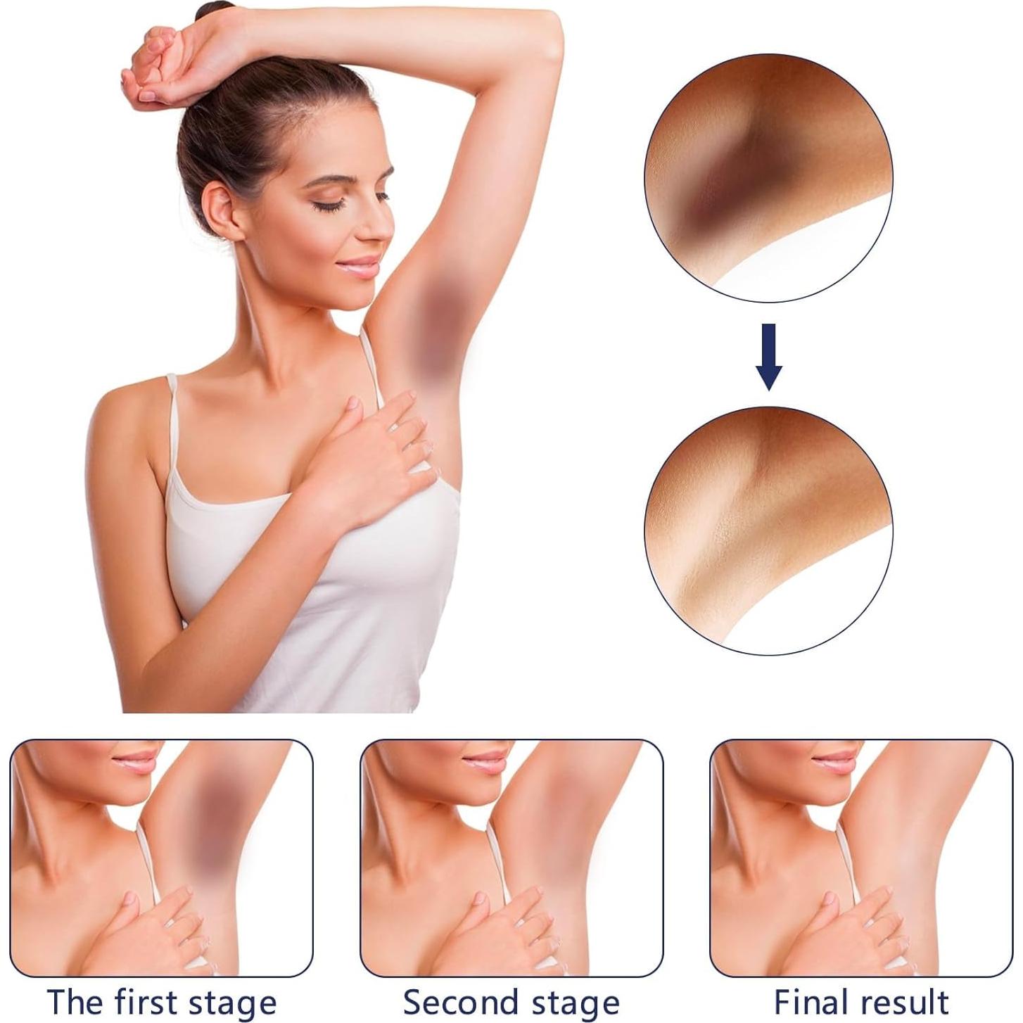 Crema Aclarante para Áreas Íntimas Gukei 91g - Blanqueadora