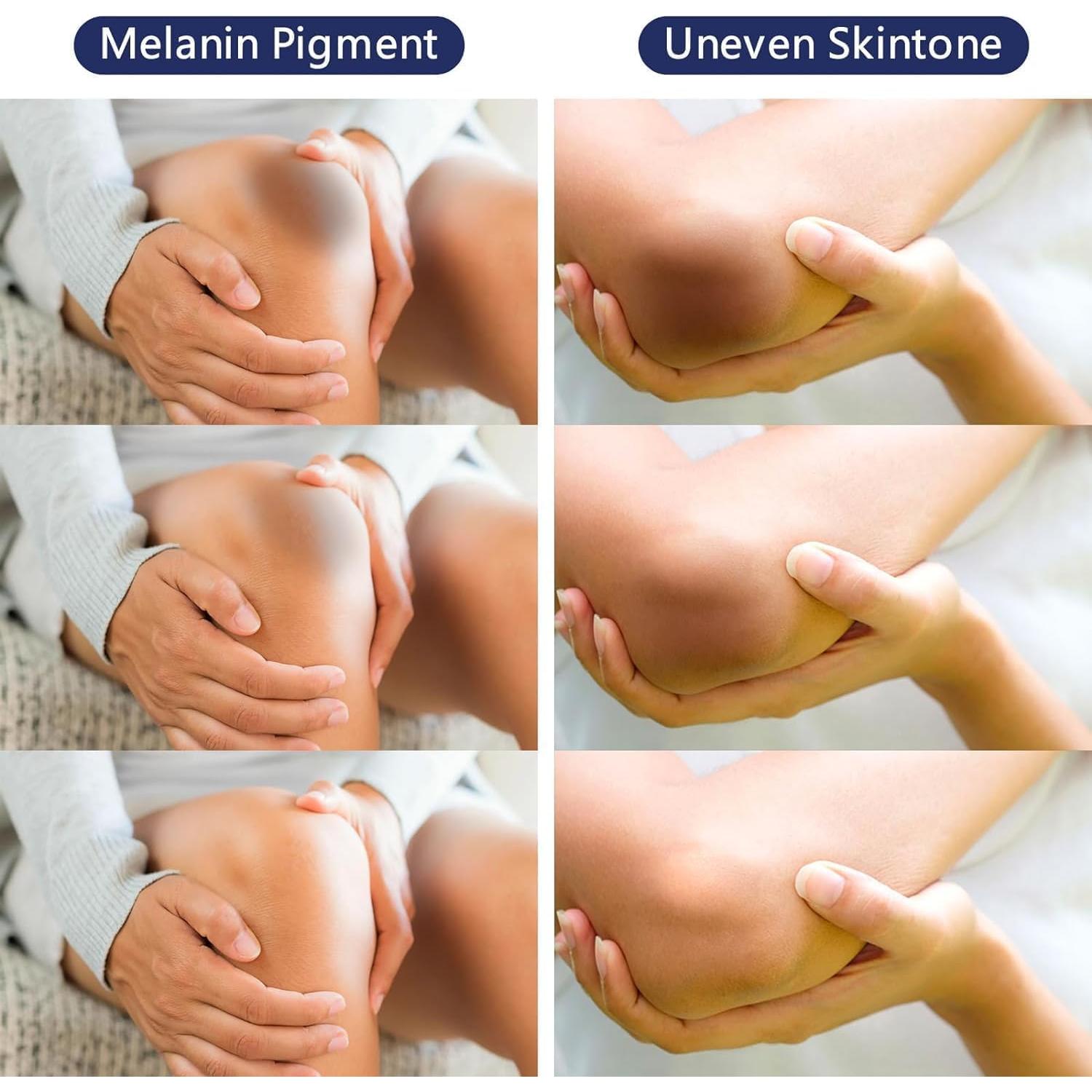 Crema Aclarante para Áreas Íntimas Gukei 91g - Blanqueadora