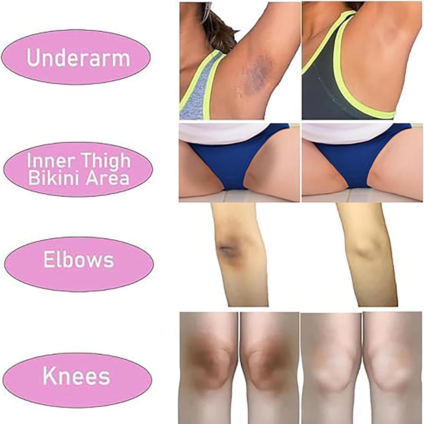 Crema Aclaradora de Piel Ceavo 30 ml Fragancia Floral