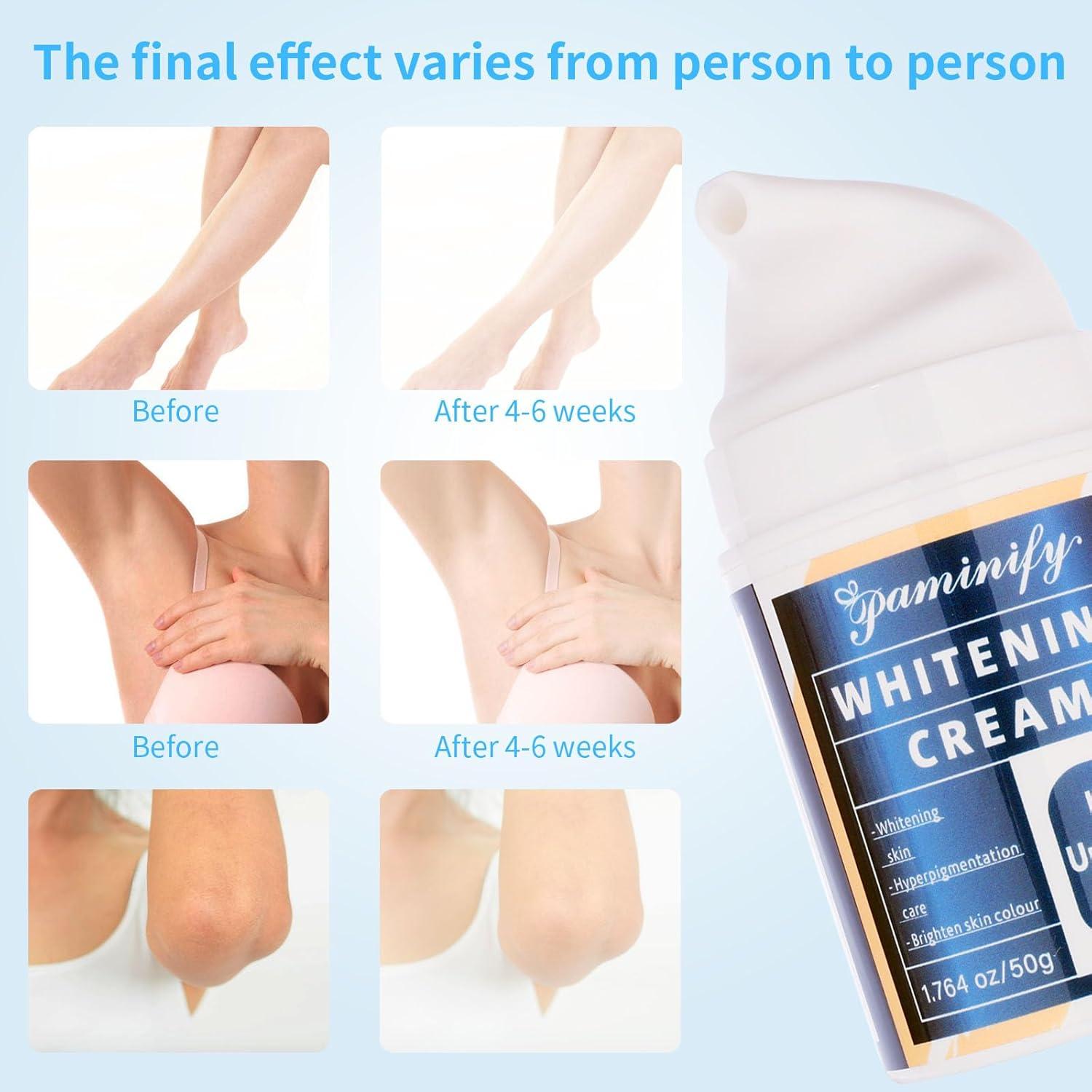 Crema Blanqueadora con Niacinamida 51g - Aclaradora de Piel