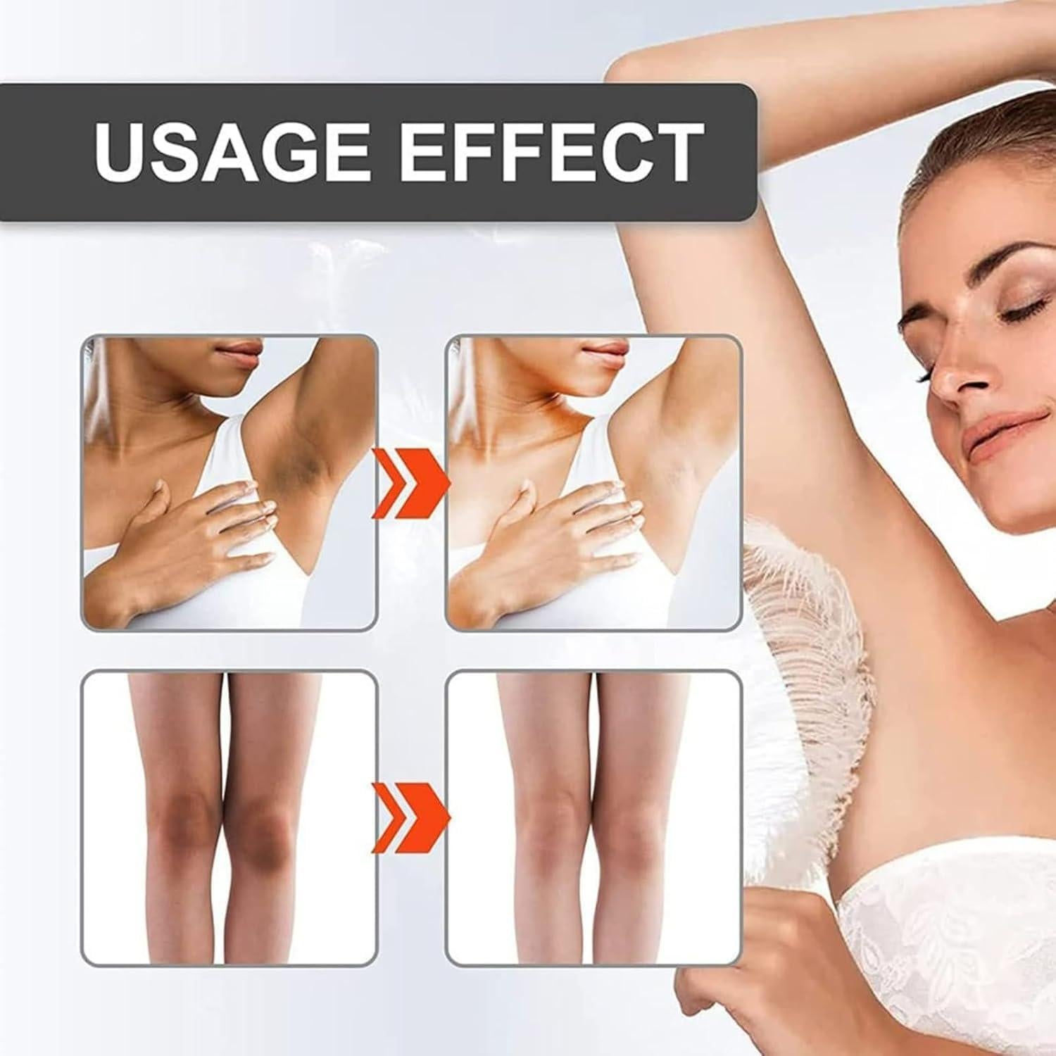 Crema Aclaradora de Manchas Oscuras Genérica 30ML - Axilas, Codos, Rodillas