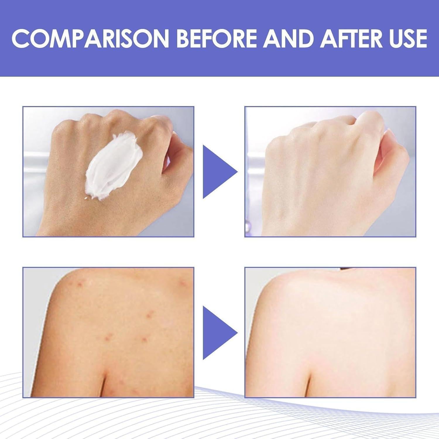 Crema Aclaradora de Manchas Oscuras Genérica 30ML - Axilas, Codos, Rodillas