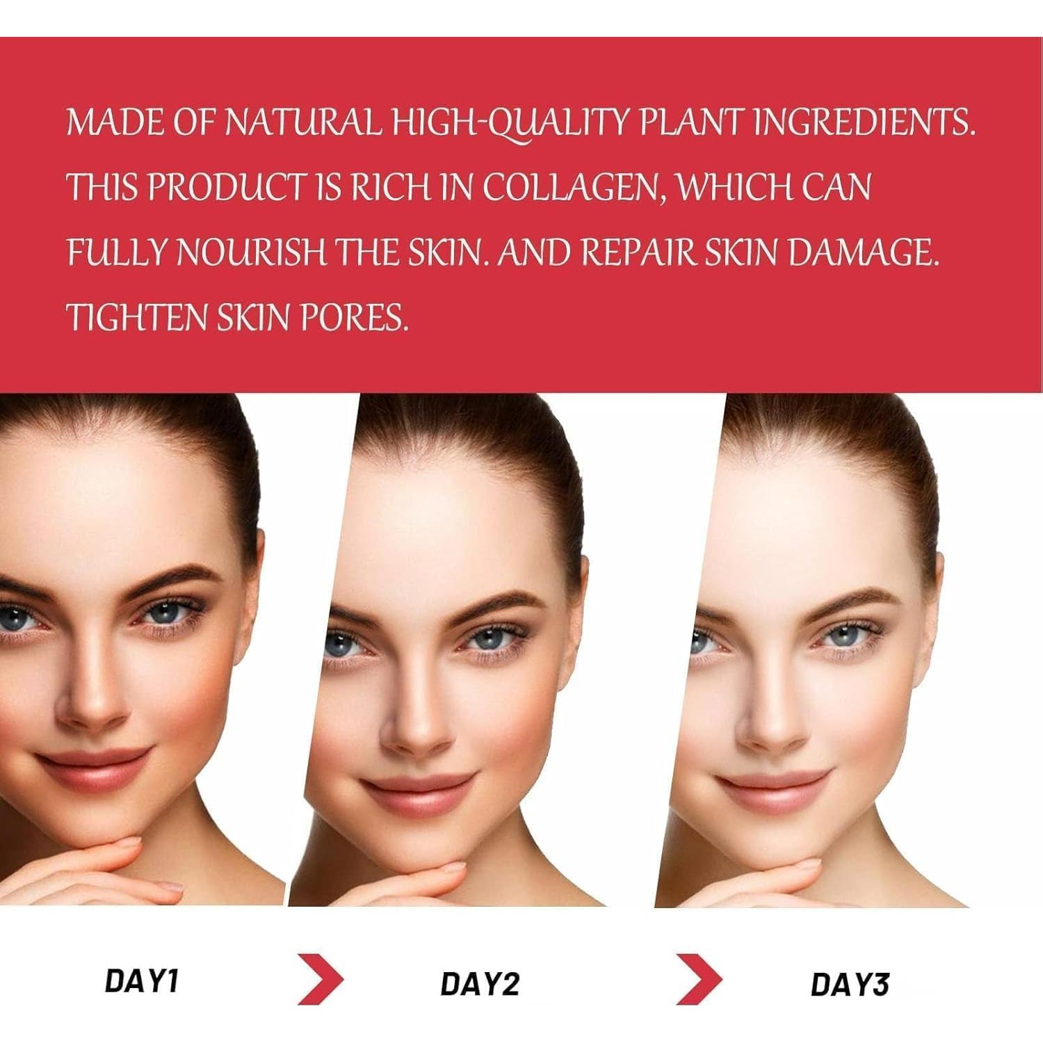 Crema Aclaradora de Manchas Oscuras Genérica 30ML - Axilas, Codos, Rodillas