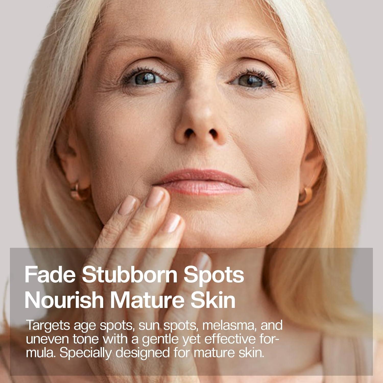 Crema Aclaradora para Manchas Oscuras Jtopyrt 181g