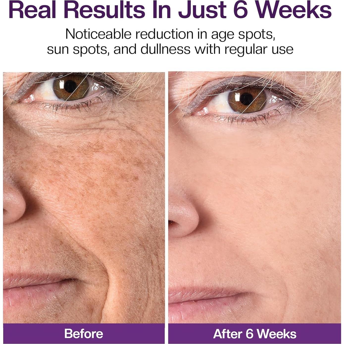 Crema Aclaradora para Manchas Oscuras Jtopyrt 181g