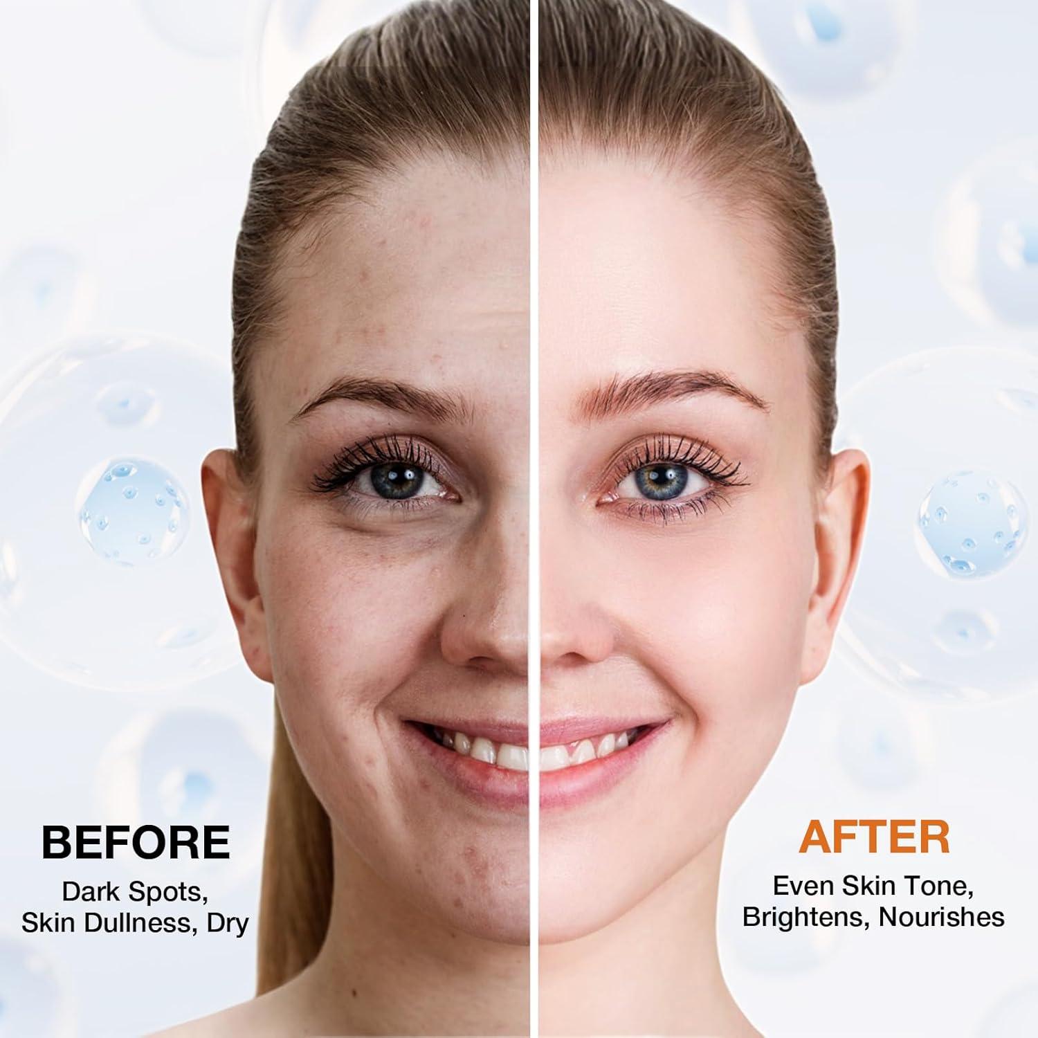 Removedor de Manchas Oscuras Ausmtal 19.9 ml con Rodillo