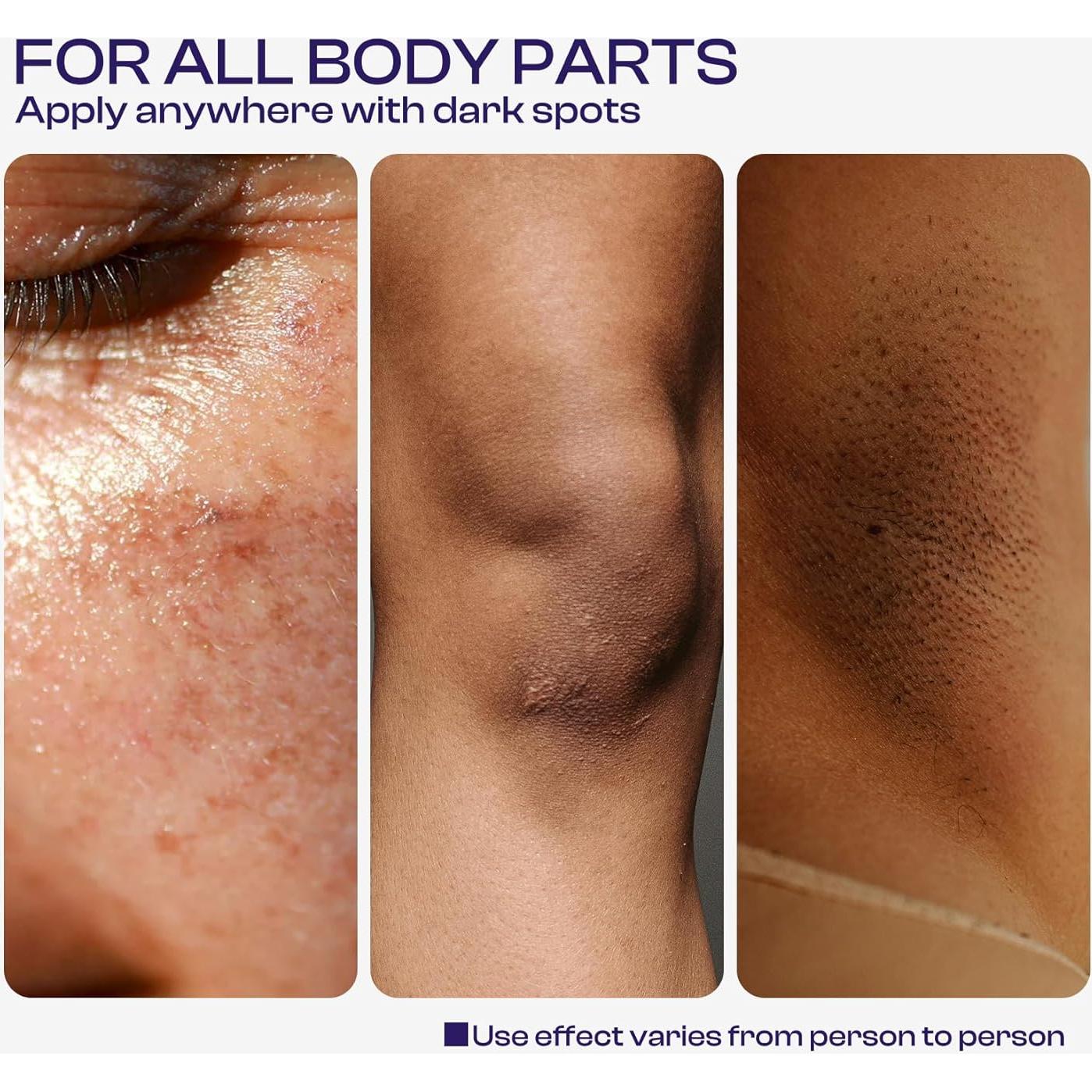 Removedor de Manchas Oscuras LHOPEBK 50ml con Niacinamida y Vitamina C