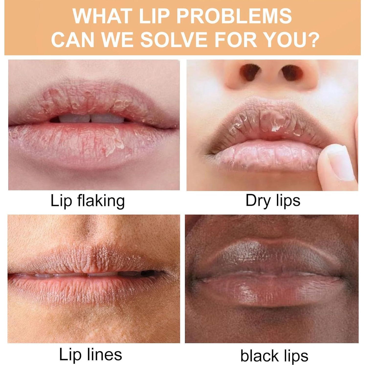 Bálsamo Labial Hidratante Natural ARCHIDATE 2 Pcs Cúrcuma