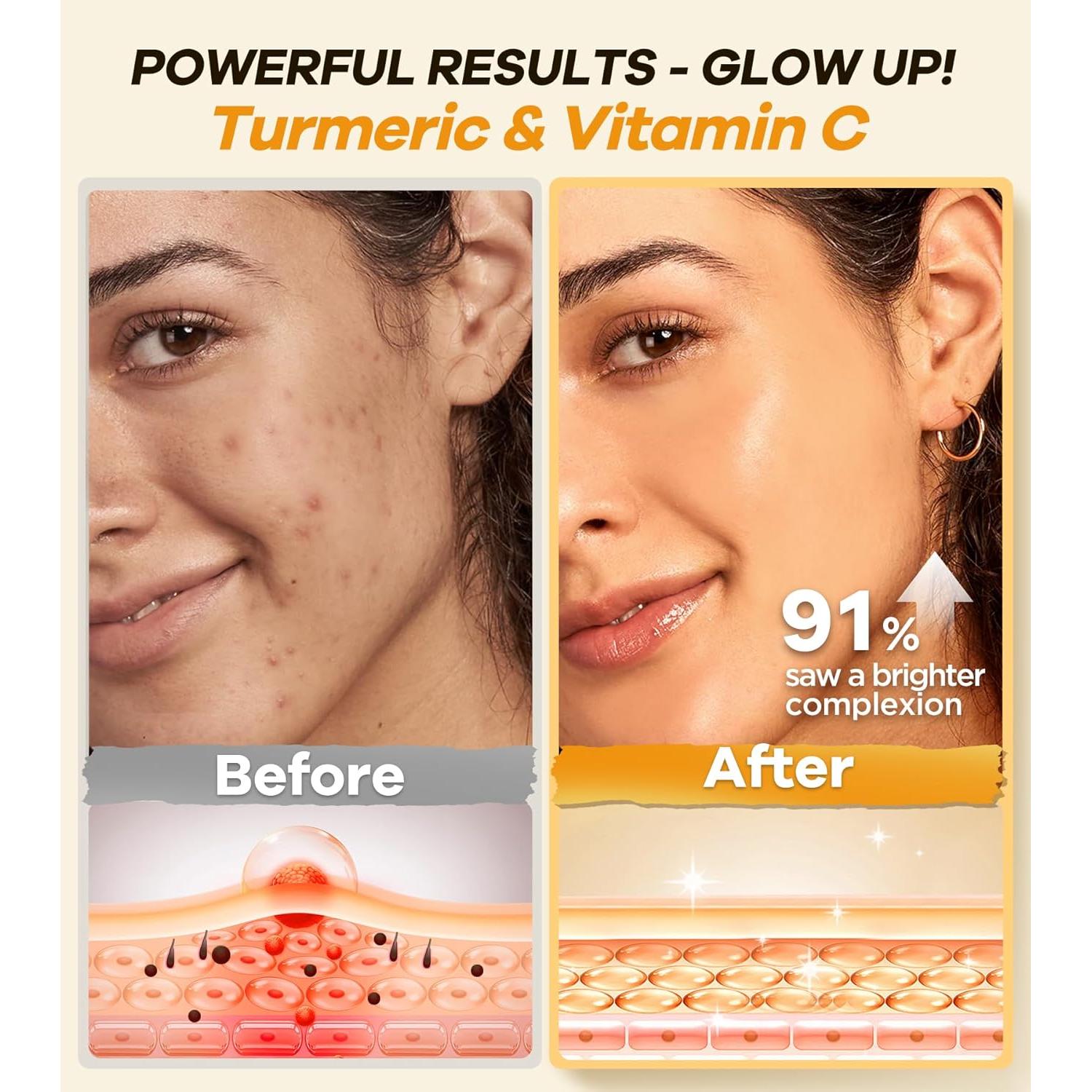 Exfoliante Facial Srripo con Cúrcuma y Vitamina C - 120g