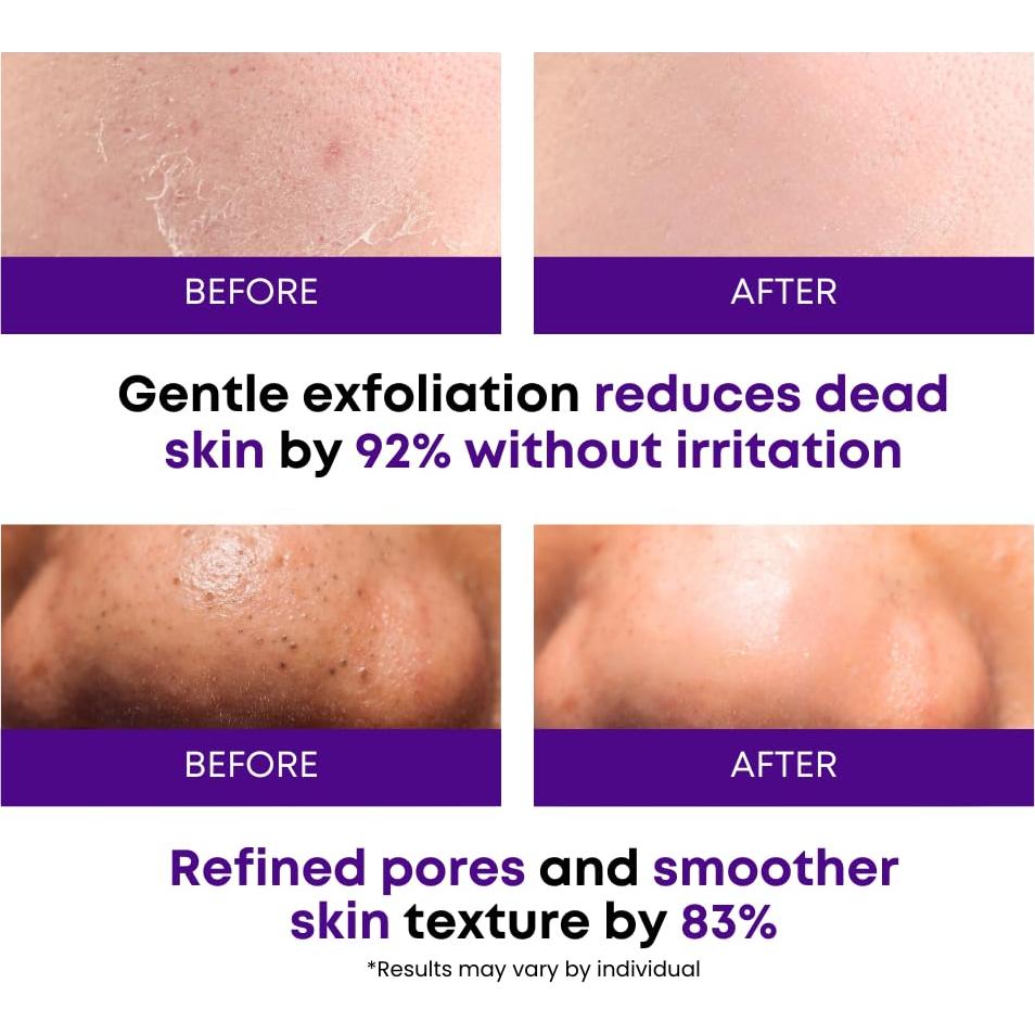 Discos Exfoliantes Coreanos Eco Glow - 50 Unidades, Doble Cara