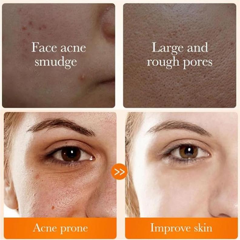 Limpiador Facial Espumoso de Cúrcuma Ginaday 181g