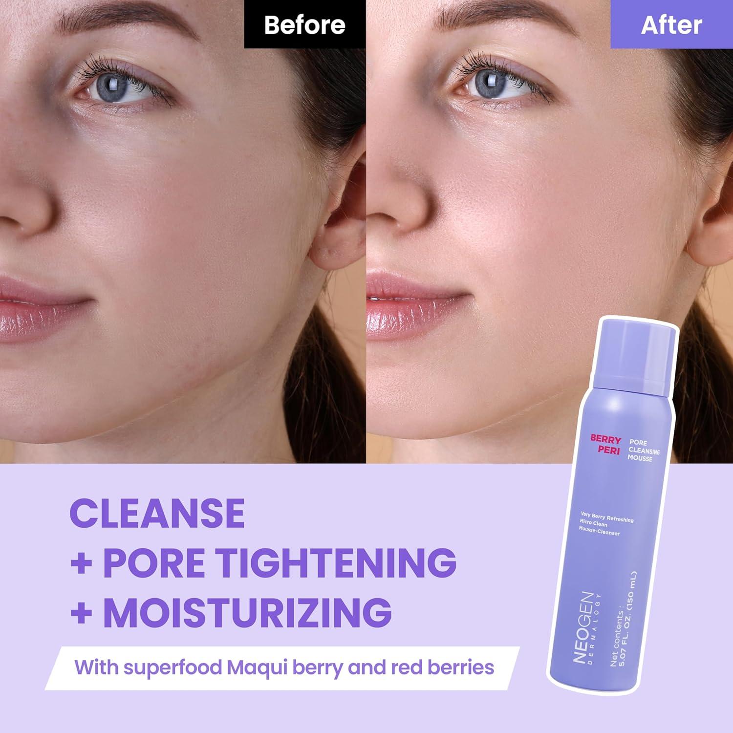 Limpiador de Poros Mousse Neogen Berrypori 150ml