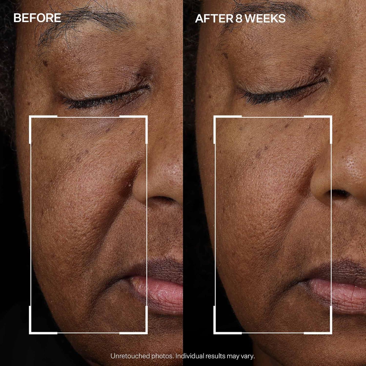 Sérum Facial StriVectin Peptight Reafirmante 136g