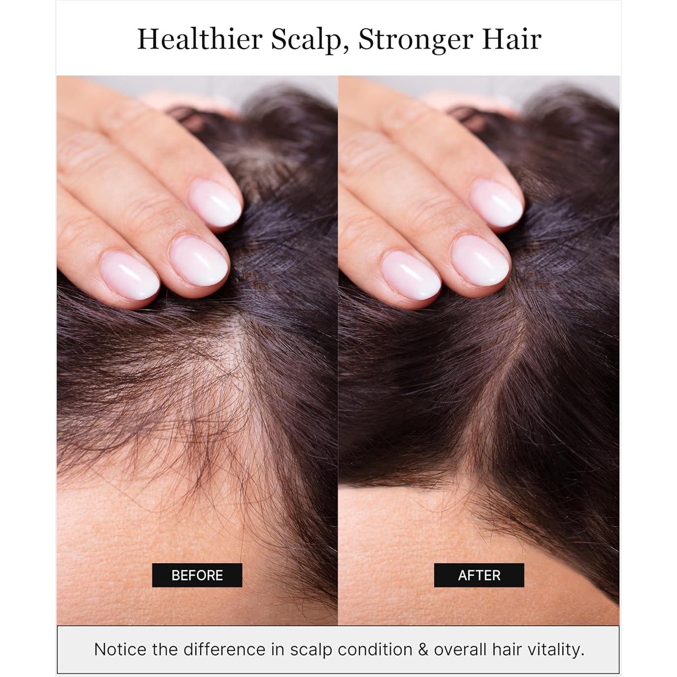 Champú Revitalizante KERACELL 227g - Crecimiento Cabello Saludable