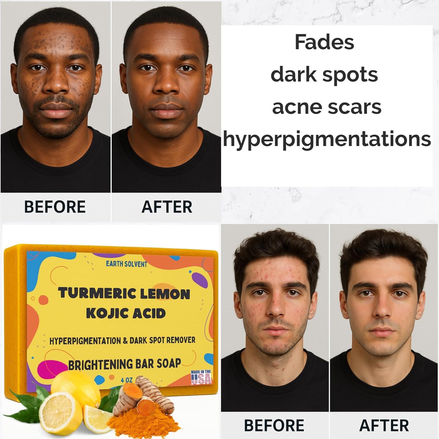 Crema Exfoliante Facial Earth Solvent 170g Vitamina C Cúrcuma