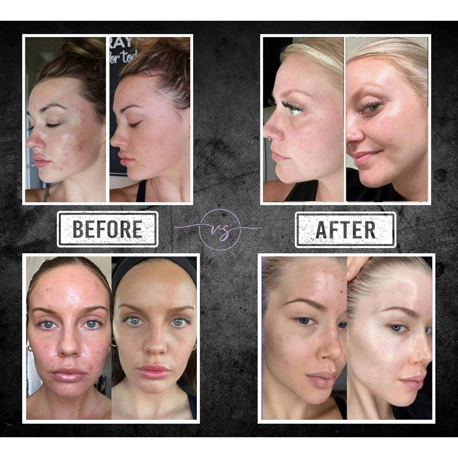 Jabón Premium Kokoromo 300g con Melatonina y Aceites Esenciales