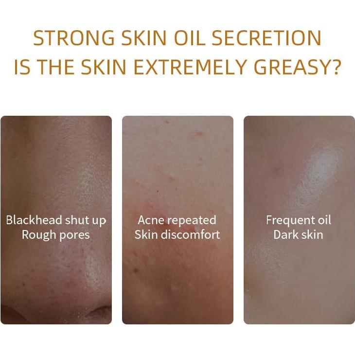 Kit de Mascarilla de Arcilla Orgánica ALPAIS - 10 Cápsulas