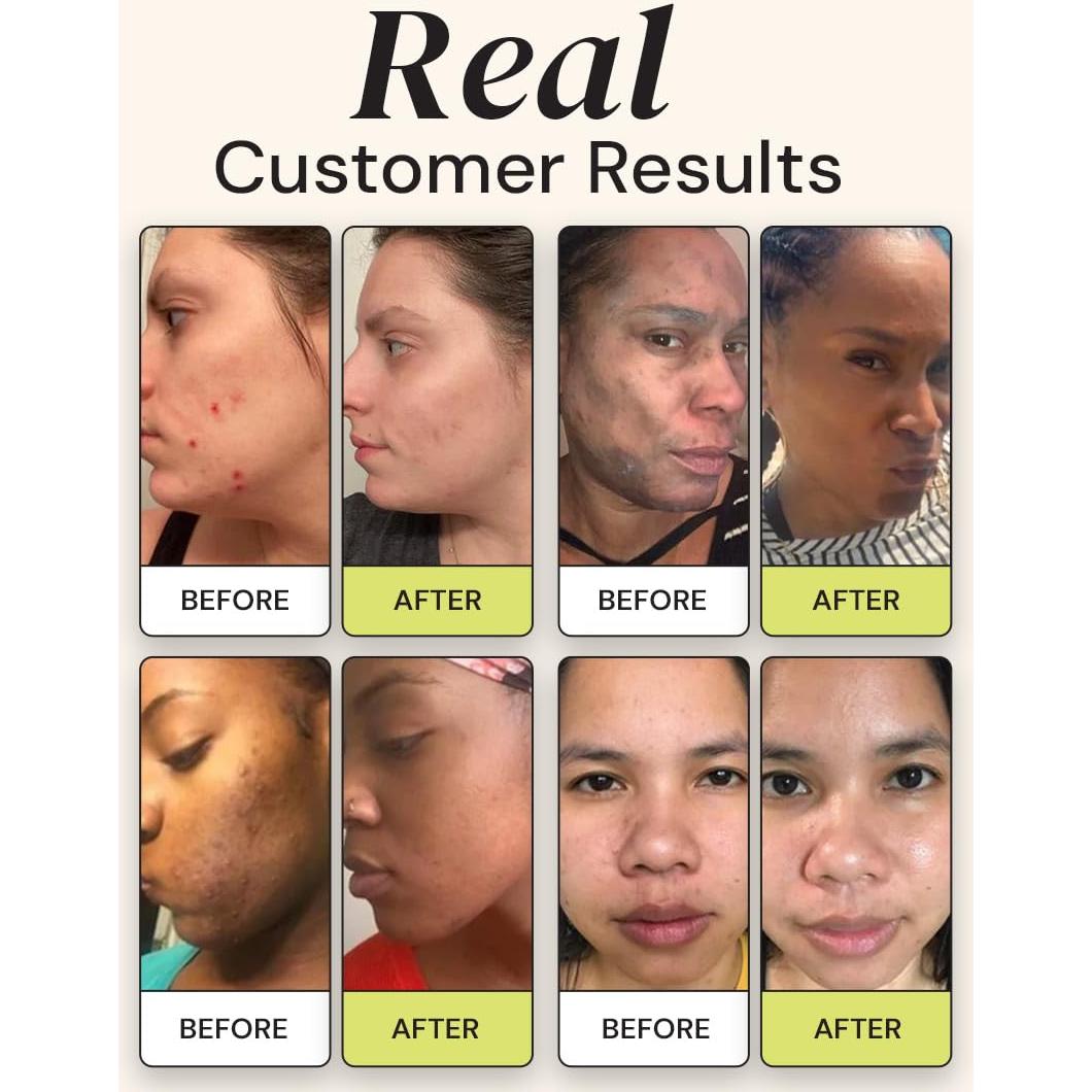 Dúo Hidratante Gleamin - Mascarilla Arcilla Vitamina C y Crema