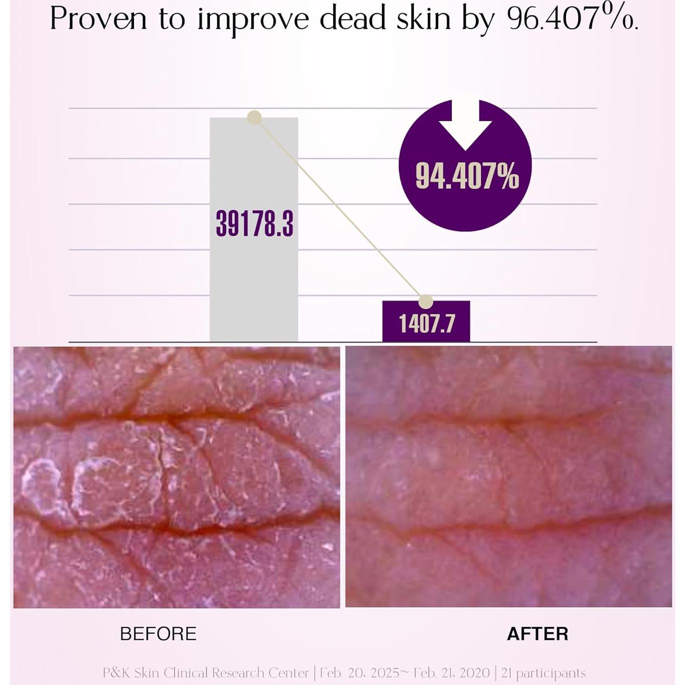 Gel Limpiador Exfoliante CNF 110g - Suave para Cara y Cuerpo