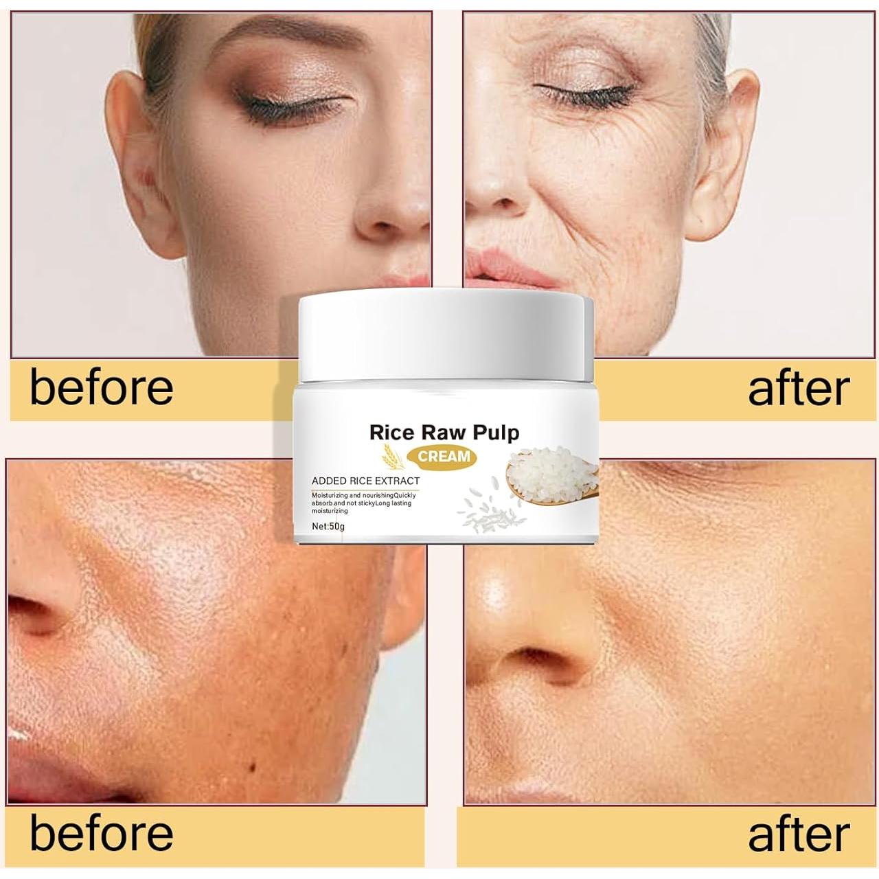 Crema Hidratante Facial Genérica con Ácido Hialurónico 70g