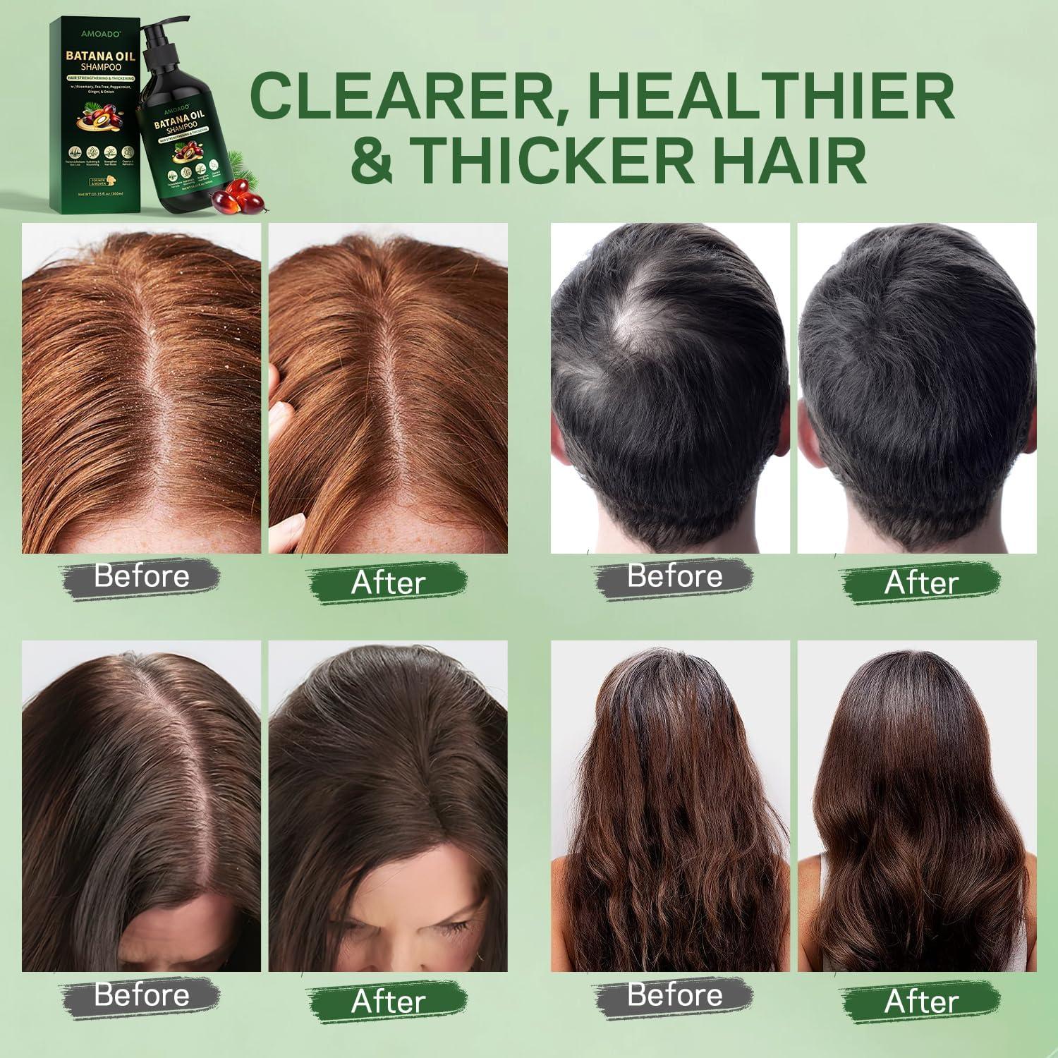 Champú Fortalecedor de Aceite de Batana 300 ml - AMOADO