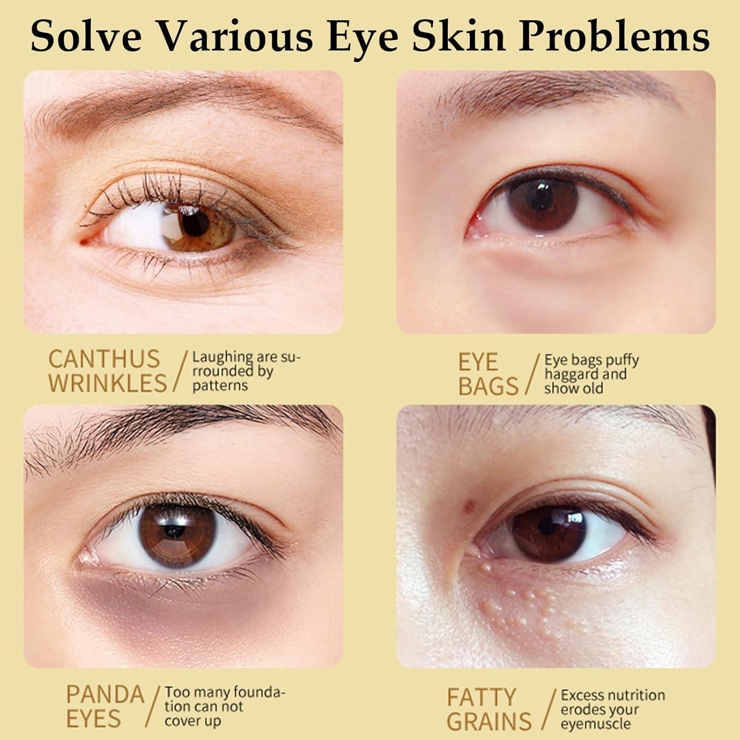 Mascarilla para Ojos de Aguacate Zozu - 60 Parches Hidratantes