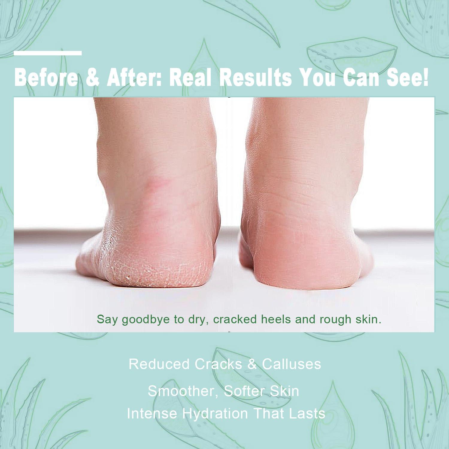 Crema de Urea 60% con Ácido Salicílico 2% - 240 g