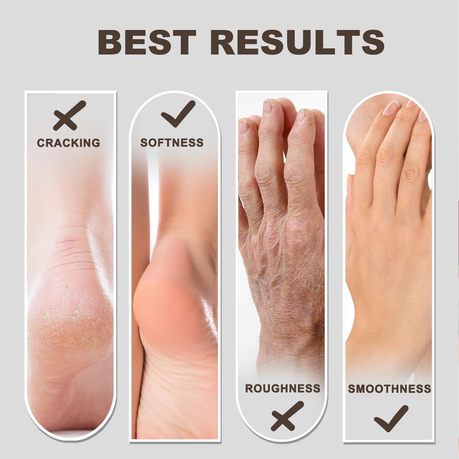 Crema Hidratante para Pies y Manos Loción 198g - 60% Urea