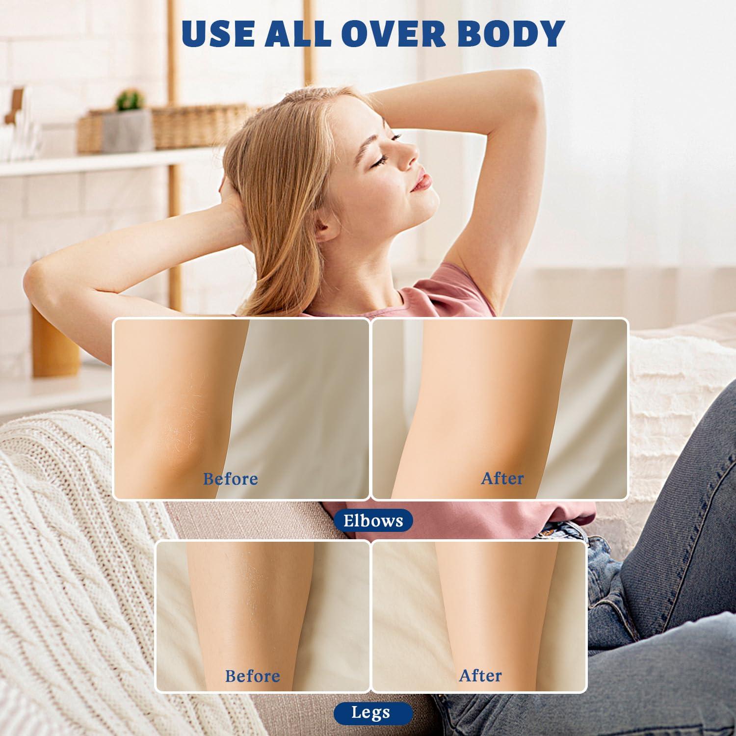 Barra Crema Urea 60% + Ácido Salicílico 2% 75g YOUNGYOUNGLOVE