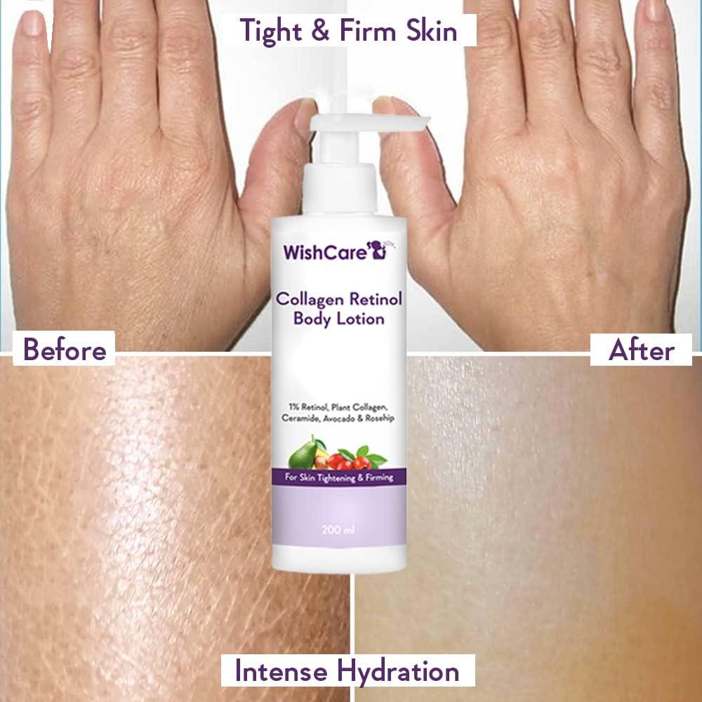 Loción Corporal WishCare Colágeno 1% Retinol 200ml - Hidratante