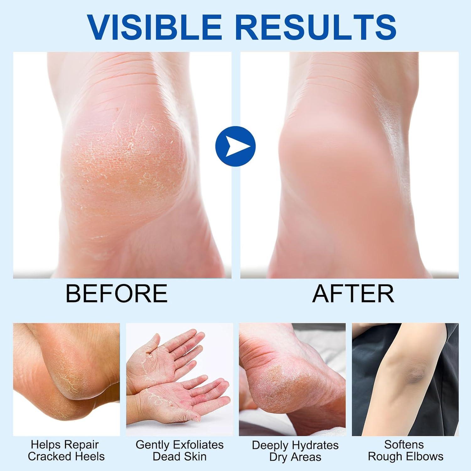 Bálsamo Reparador de Talones Agrietados NovaCharm 60% - 2 Piezas