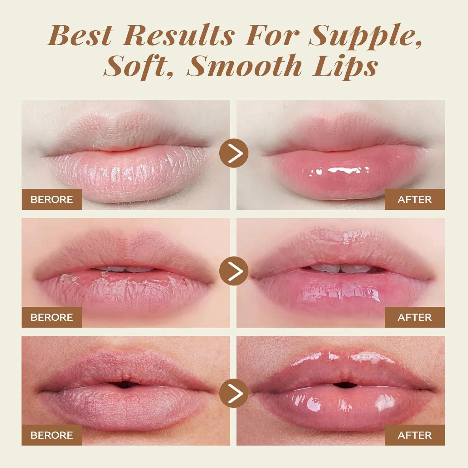 Conjunto Exfoliante y Mascarilla Labial ANAI RUI Coco 68g