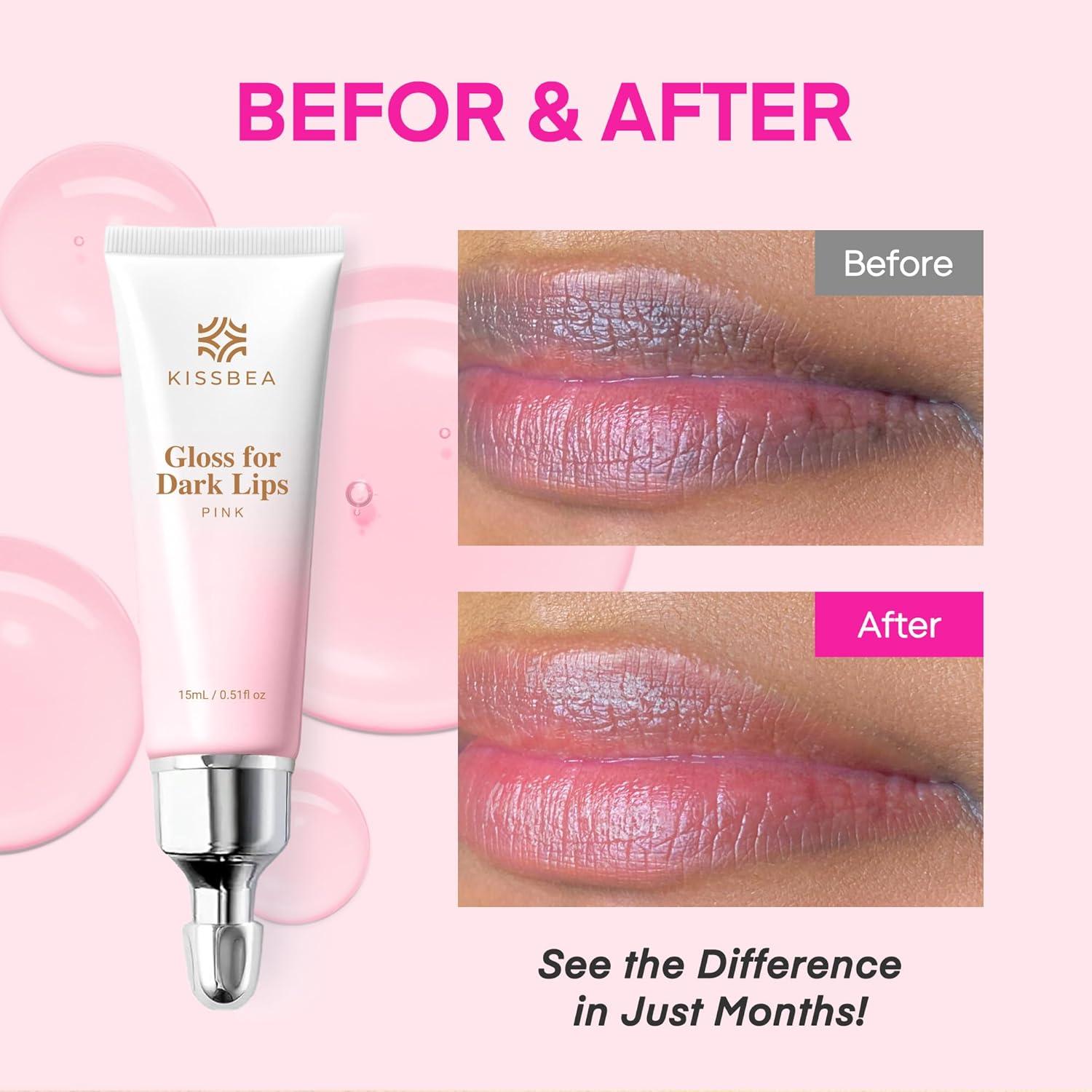 Aclarador de Labios Oscuros Kissbea 15 mL - Hidratación Natural