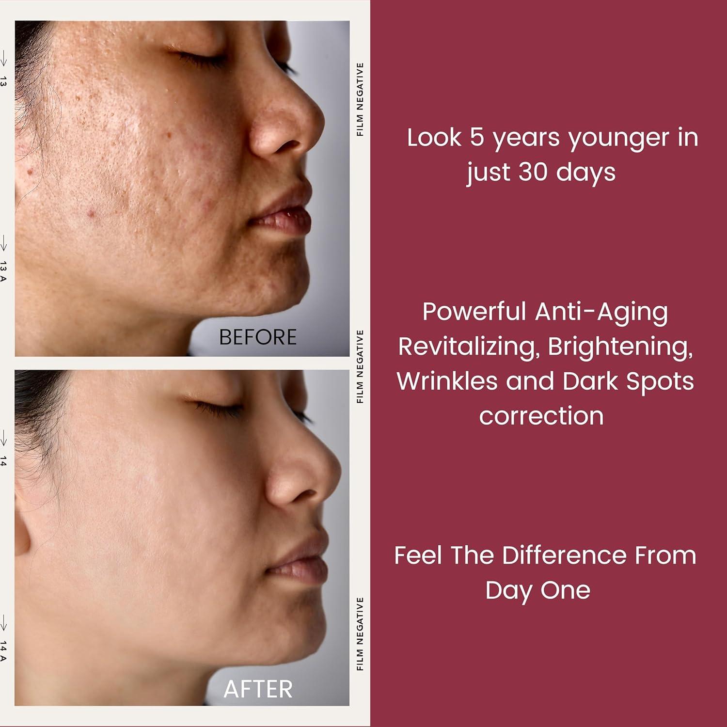 Cápsulas de Suero de Retinol Puro 2.5% Turbinne - 30 Unidades